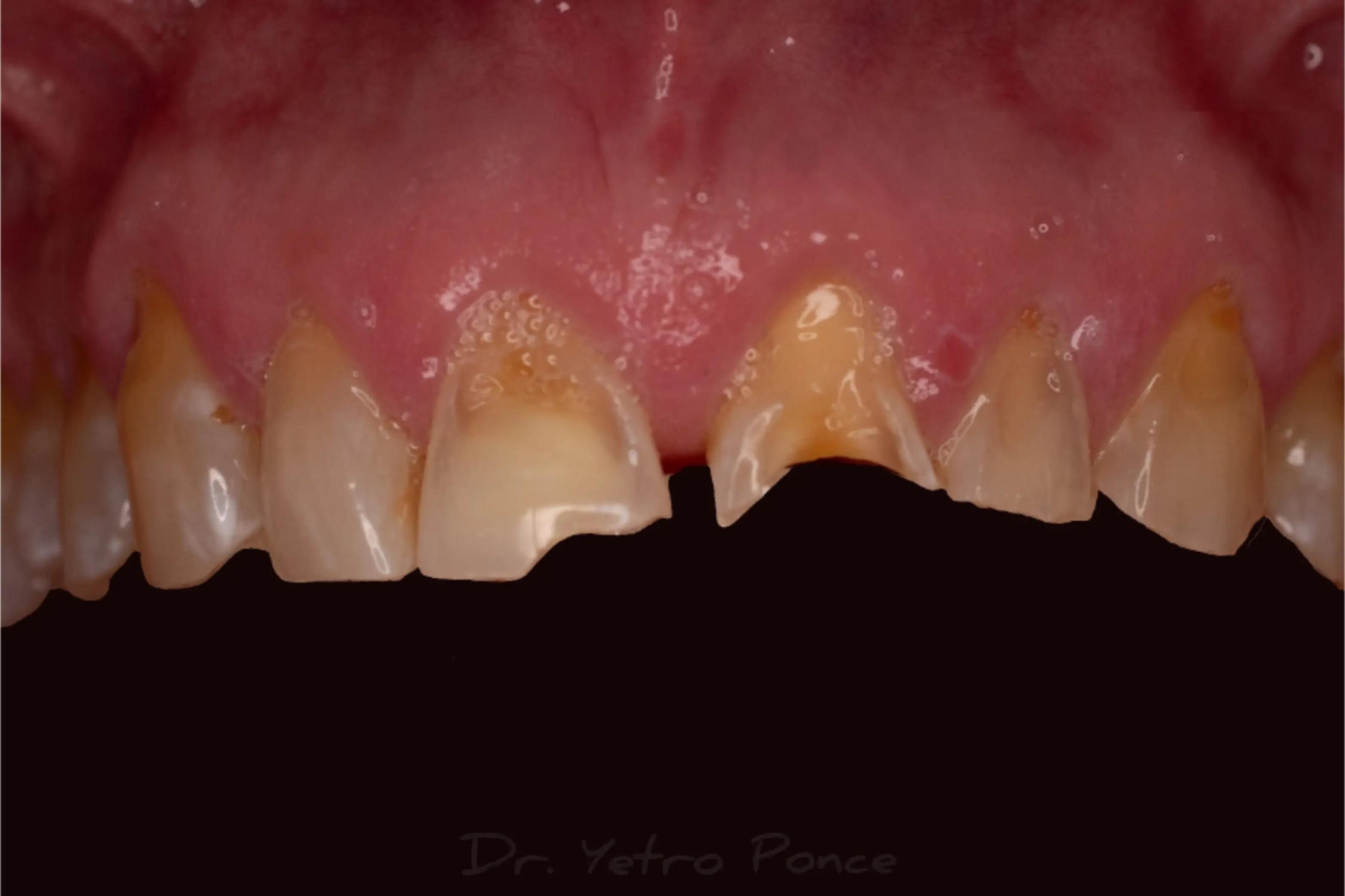 @Dr. Yetro Ponce