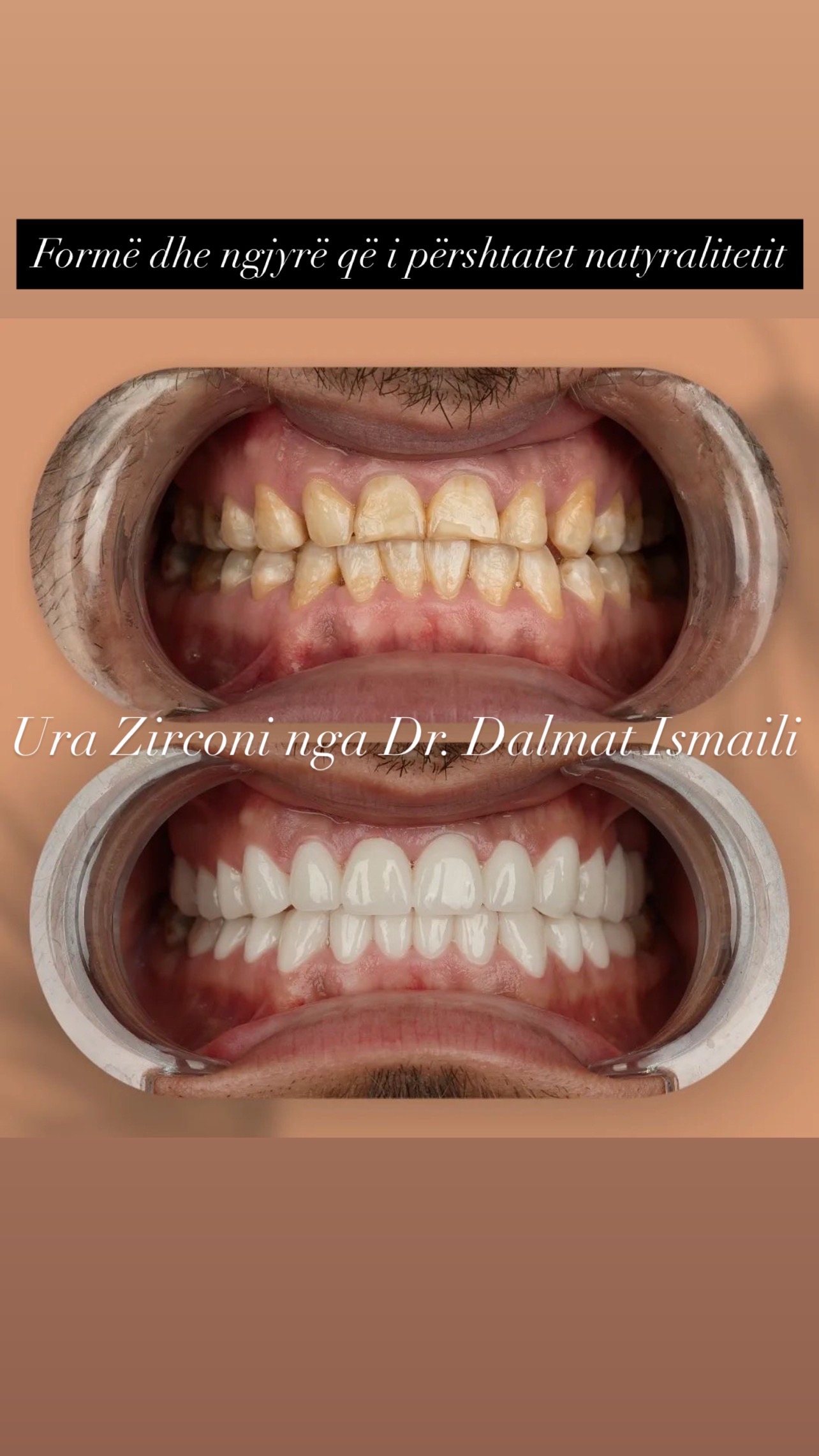 @Dr. Dalmat Ismaili