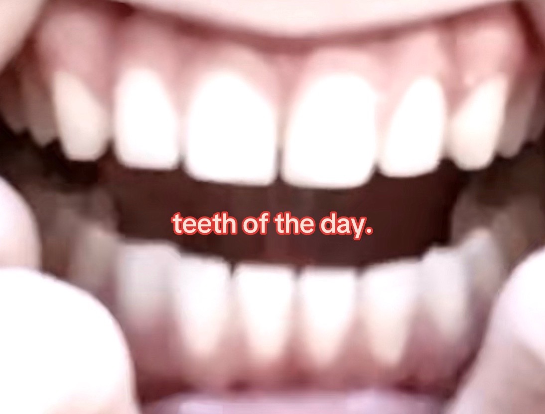 @I leik teeth moer thna mysefl.