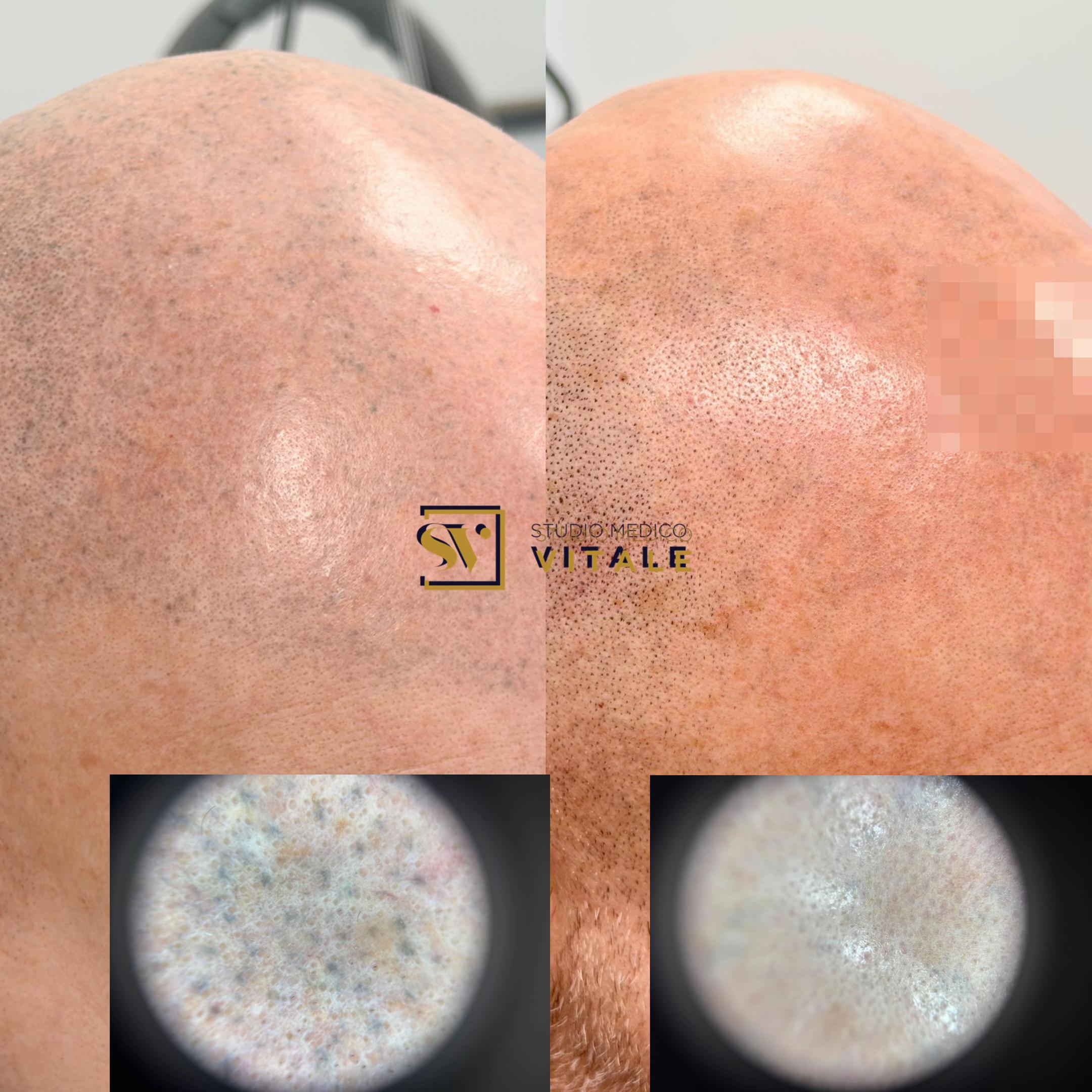 @Dr. Massimo Vitale