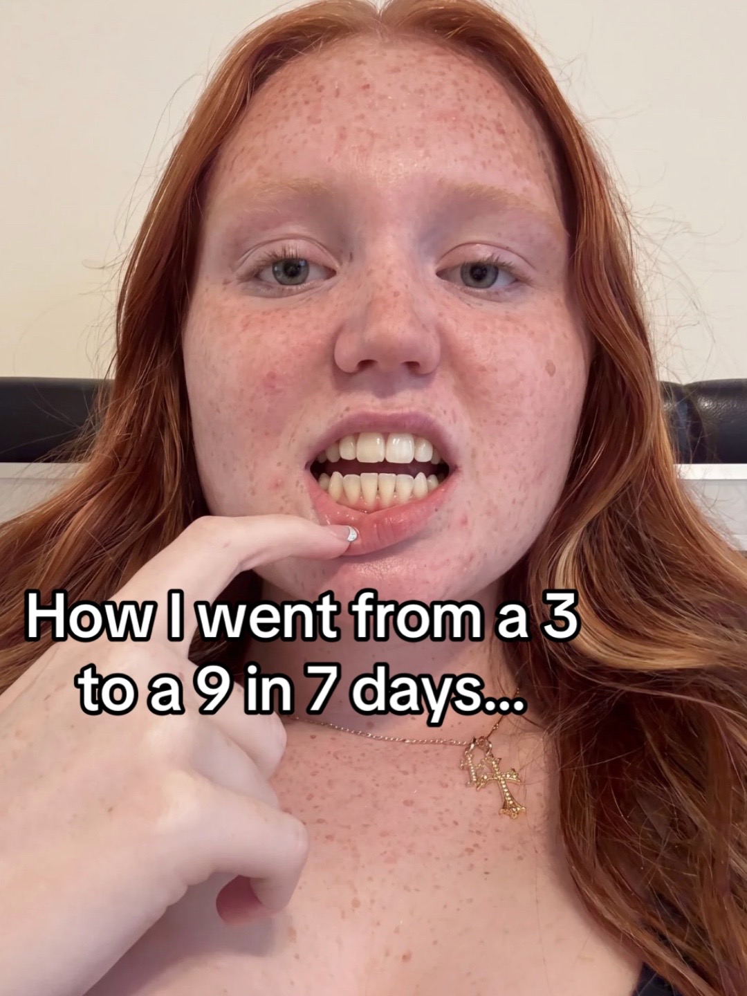 @A