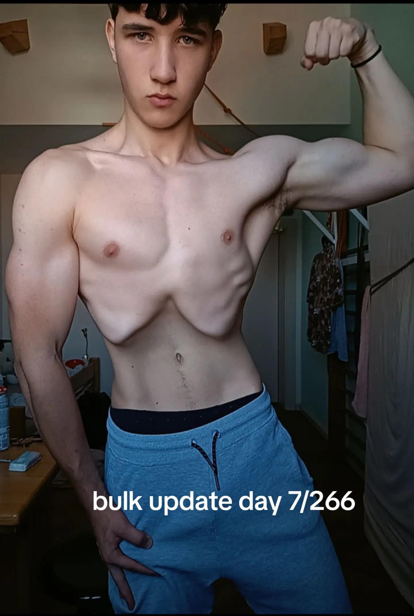 @FeralSev