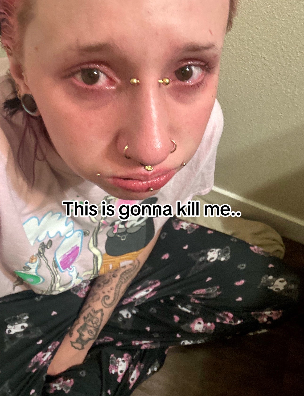 @ems🐞