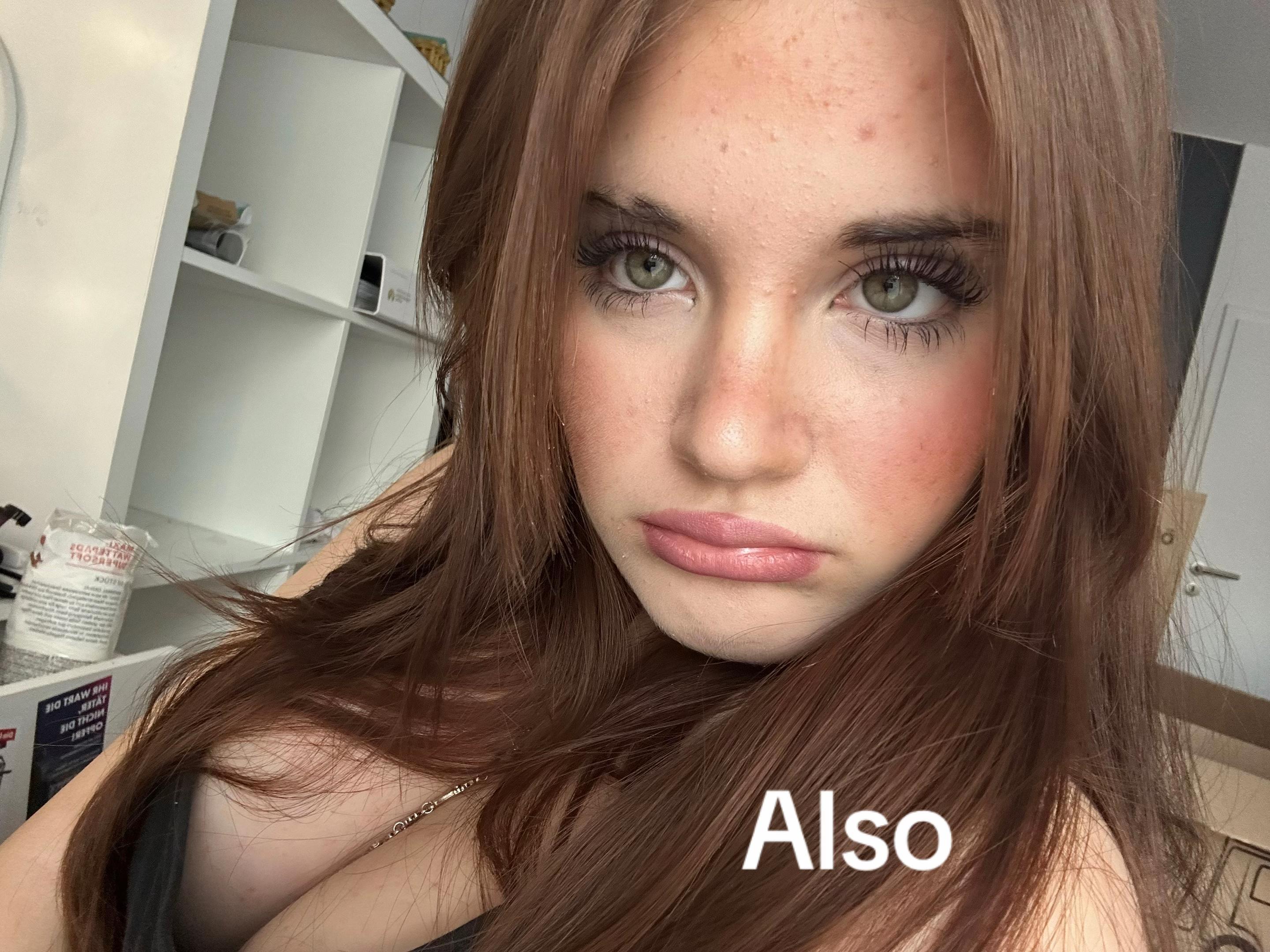@onylx_rosa