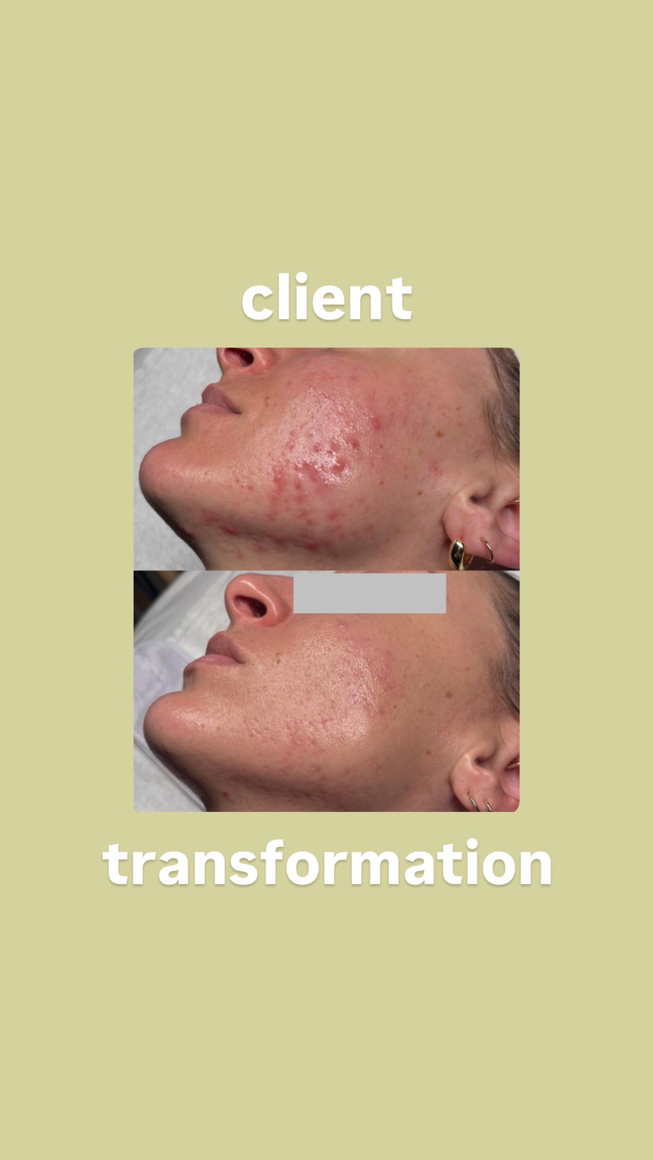 @Doctor Sheyda | Acne Expert
