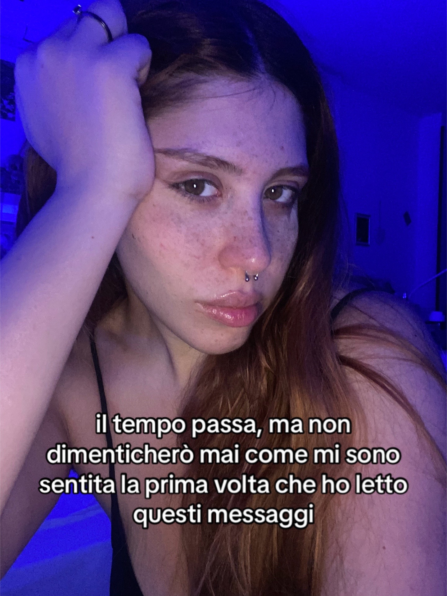 @ketoprophede