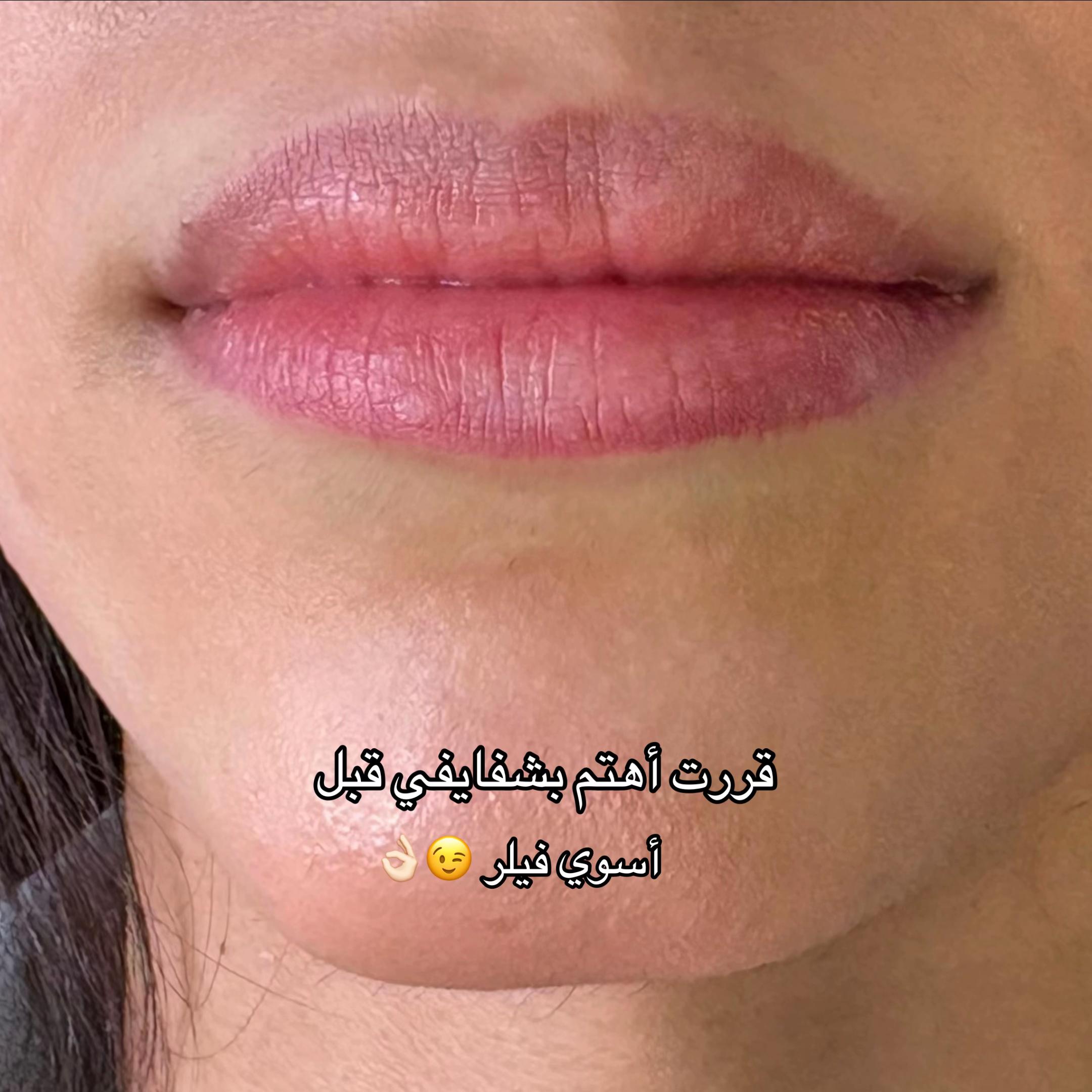 @مزدانه (فرع الملك عبدالله)