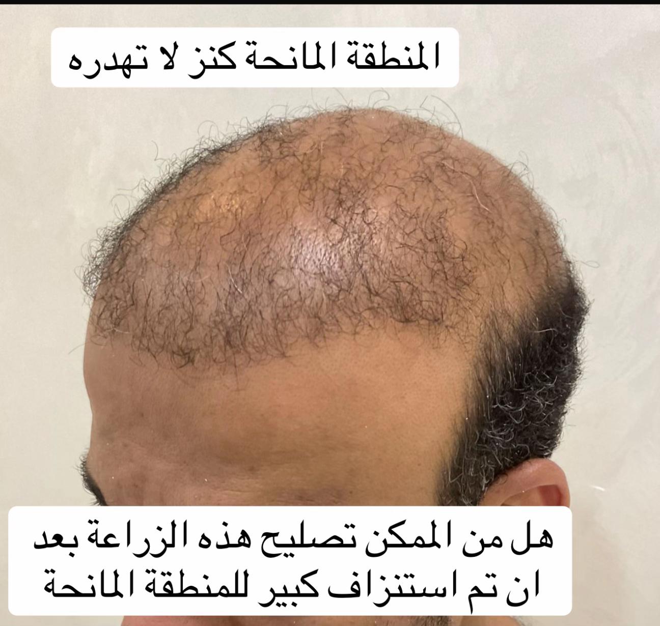 @Dr. Ahmed Alkhateeb