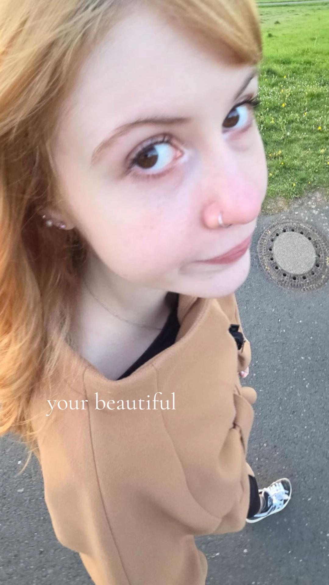 @:b