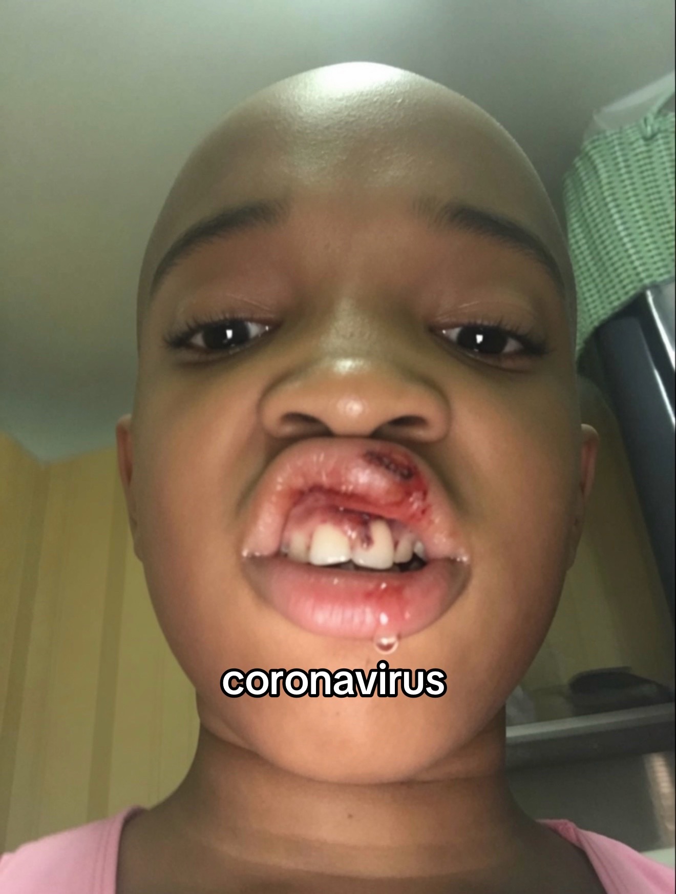 @𝐀𝐋𝐄𝐗𝐈𝐒 𝐃