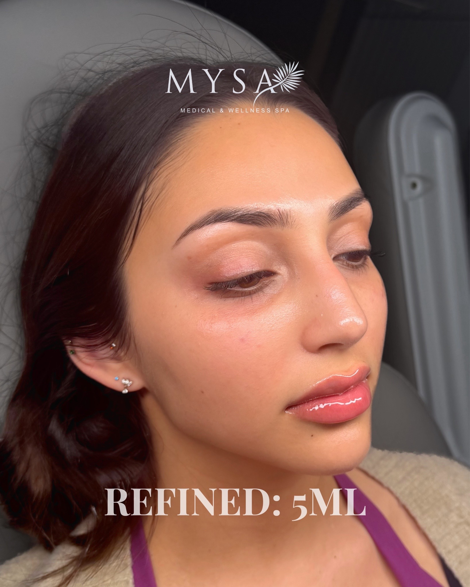 @Mysa Medical & Wellness Spa