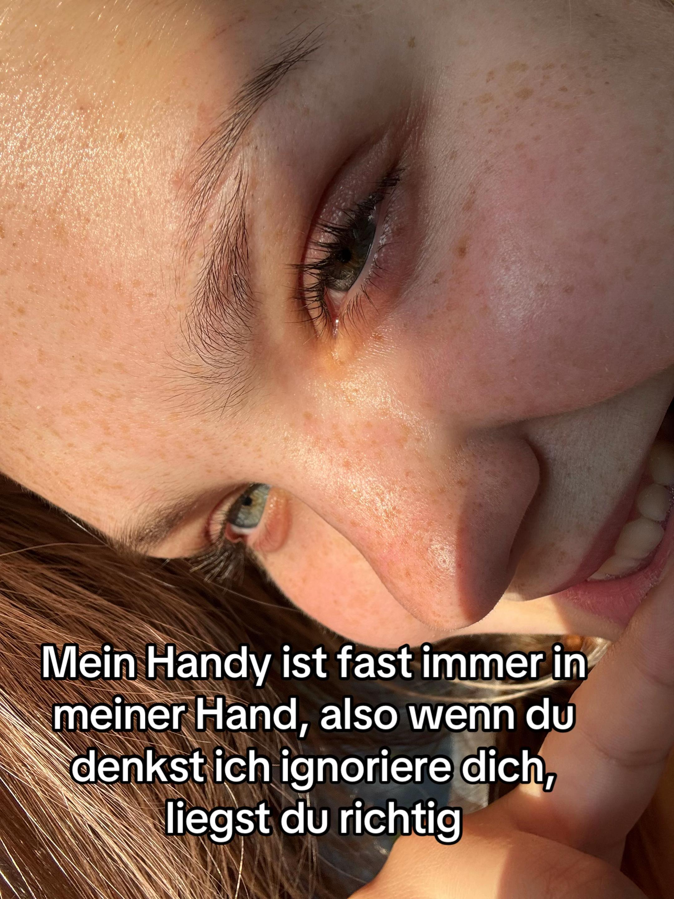 @AMELY