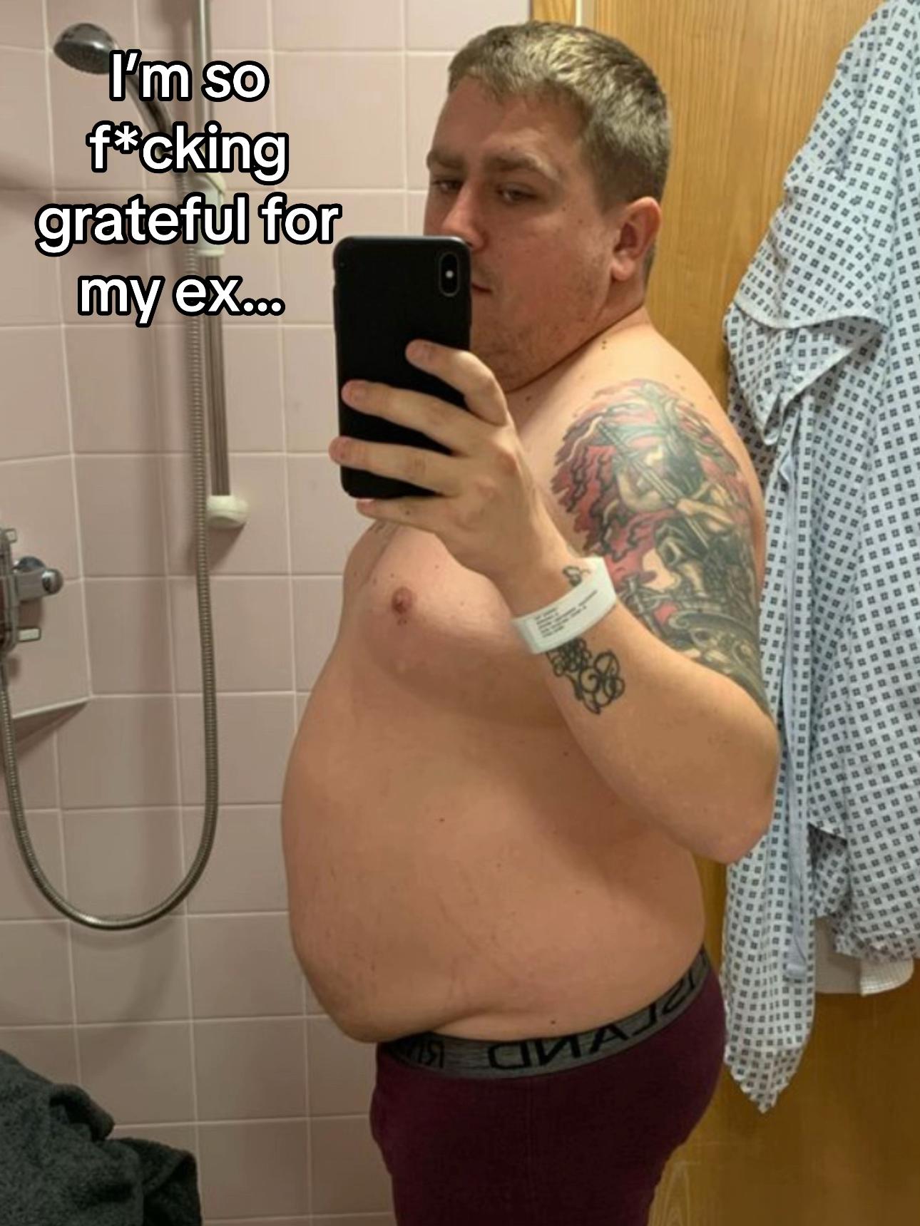 @KD | Life After Weight Loss