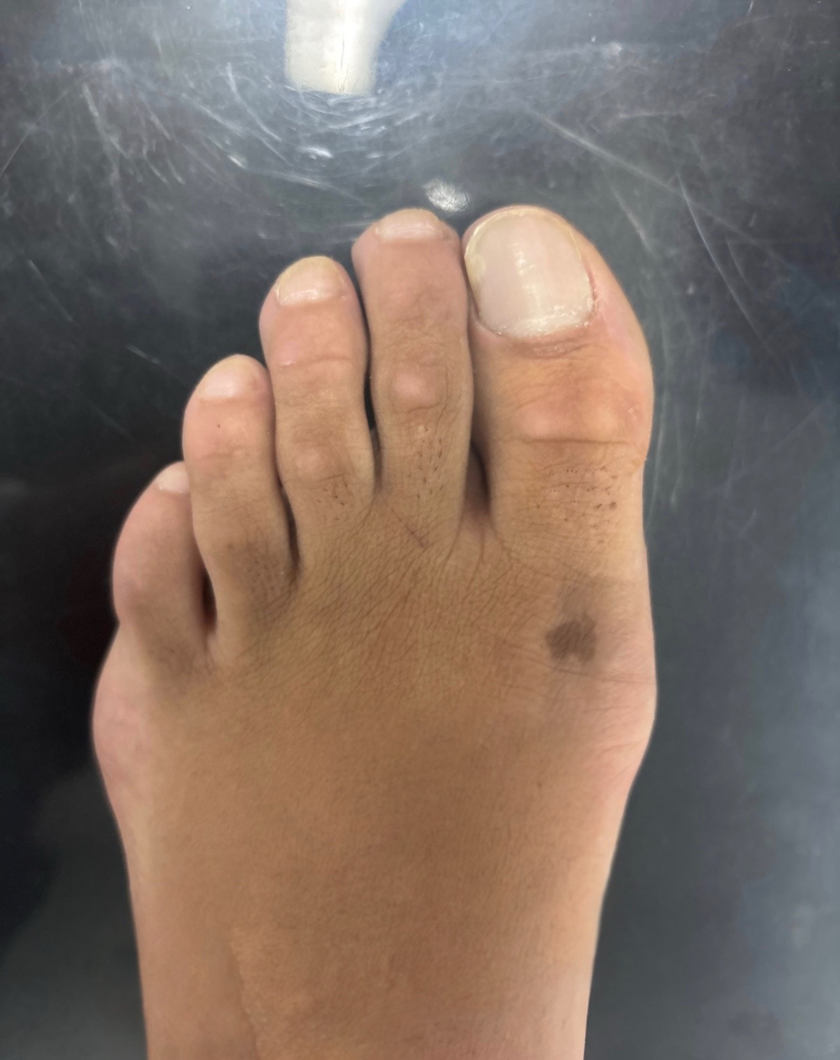 @Deniel Foot and Ankle Center