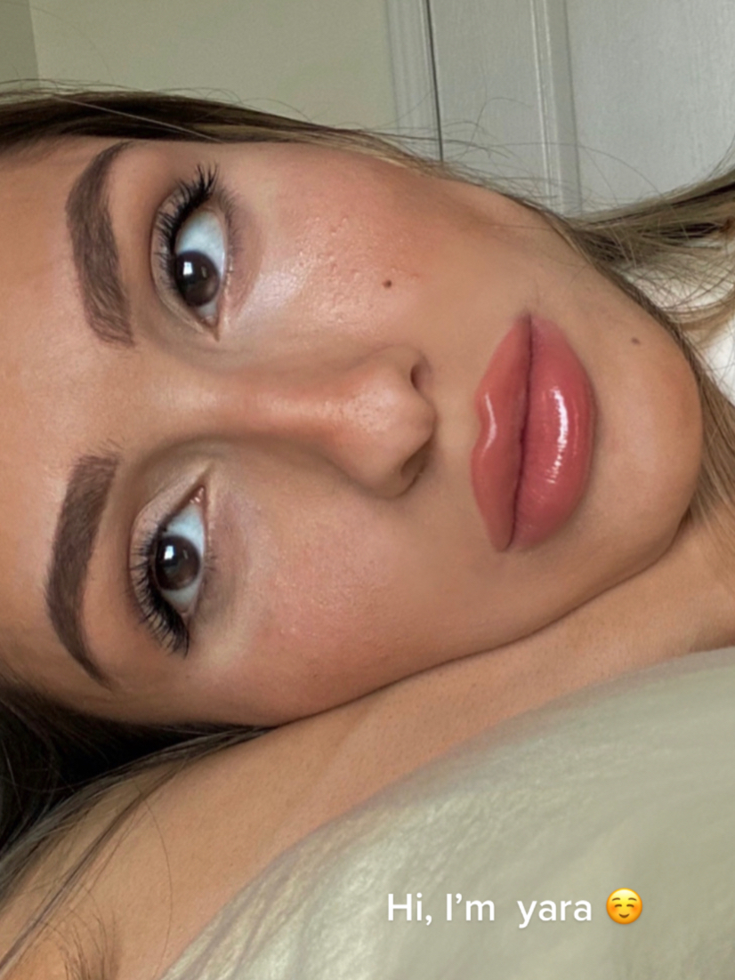 @Yara