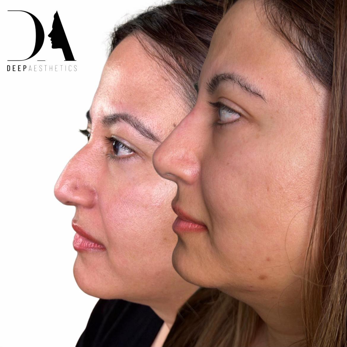 @deepaesthetics_official