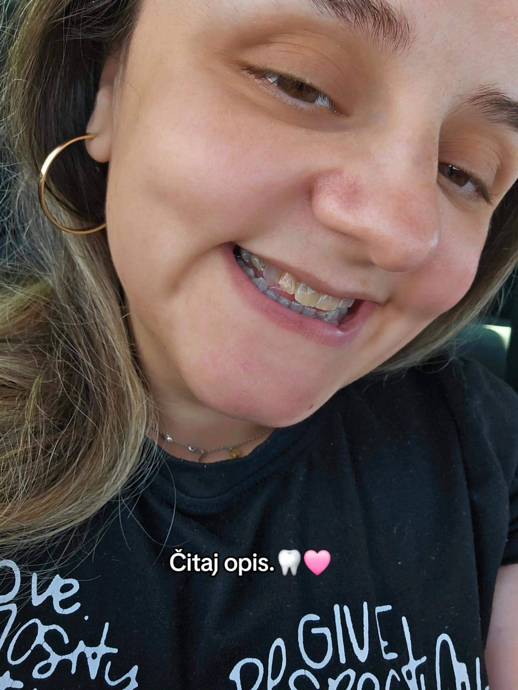 @Arbnora Elezi👩🦽