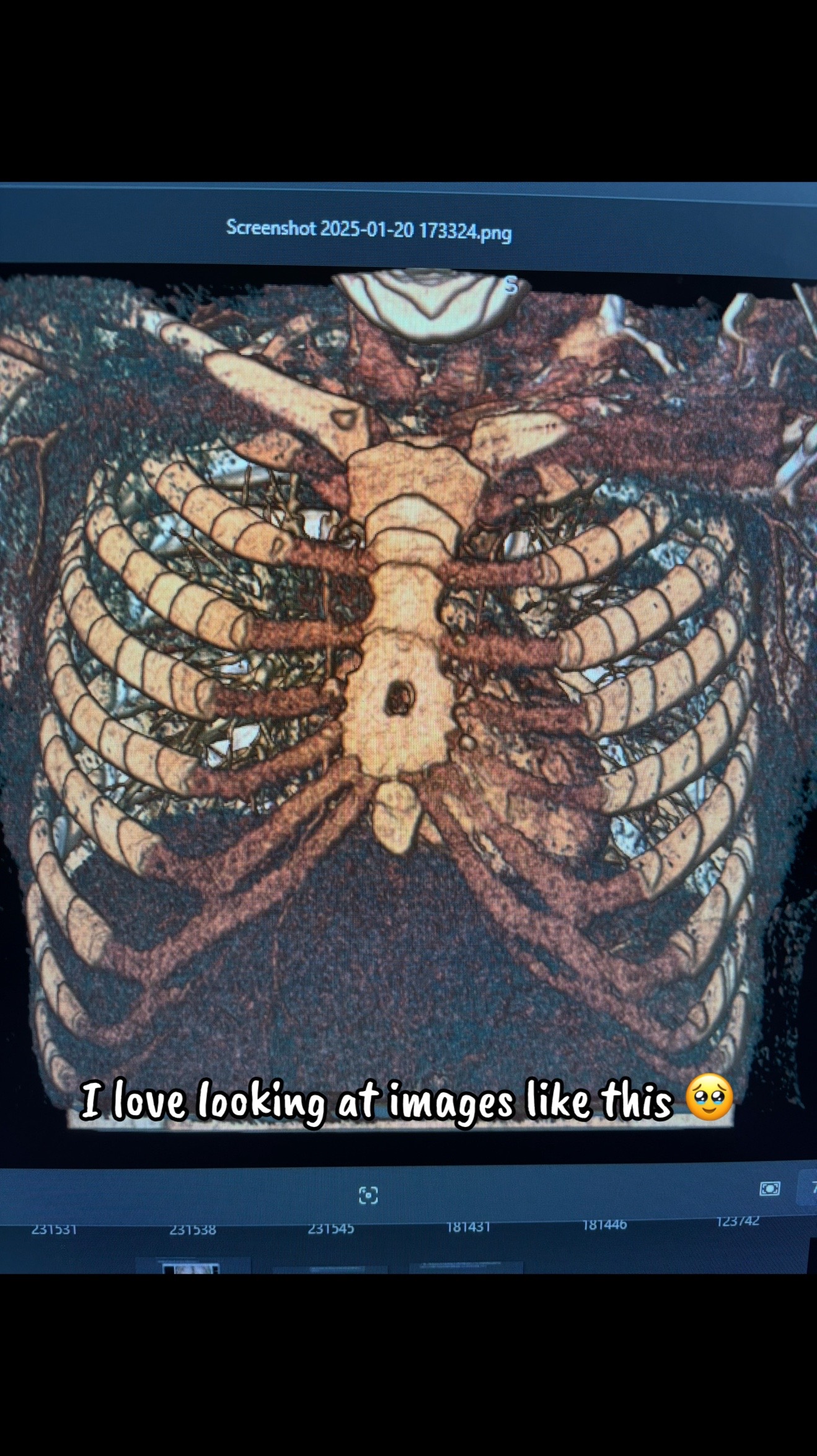 @The Invisible Diagnosis