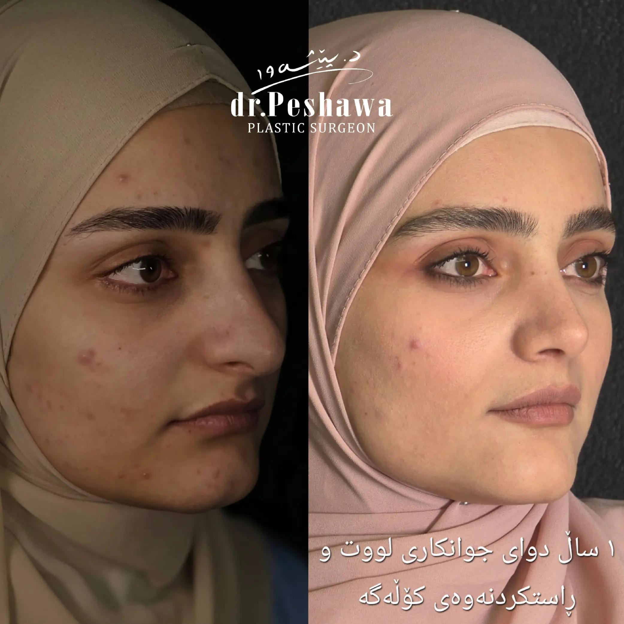 @Dr. Peshawa Plastic Surgeon