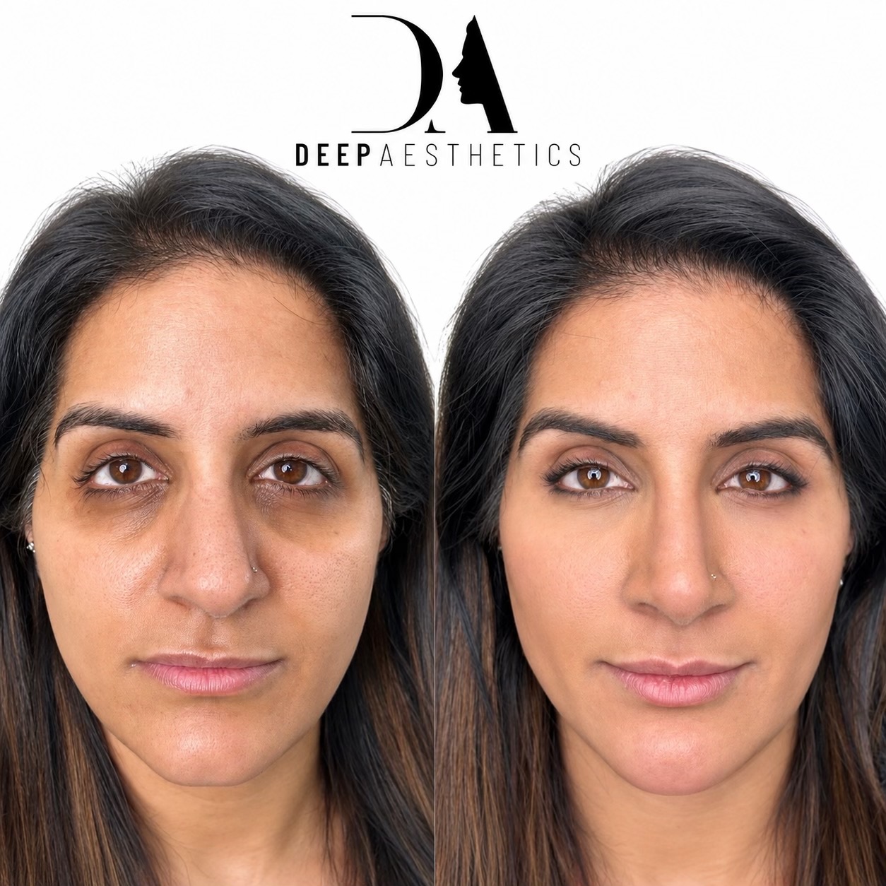 @deepaesthetics_official