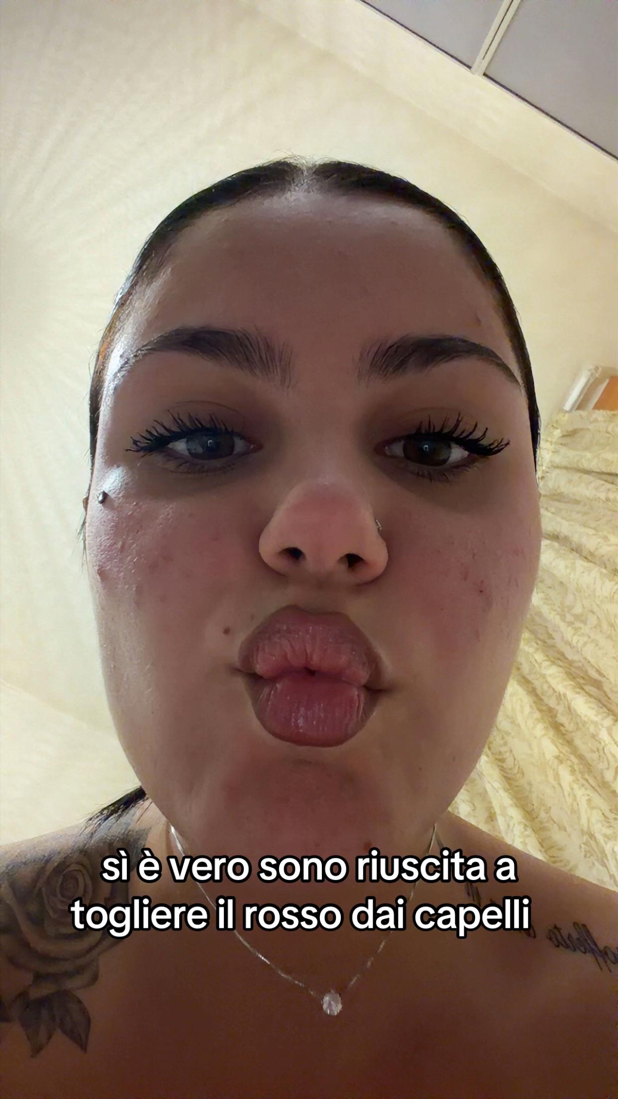 @ale