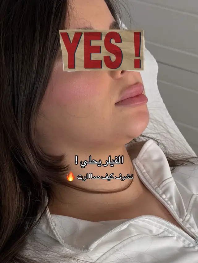 @مراس فرع النزهة