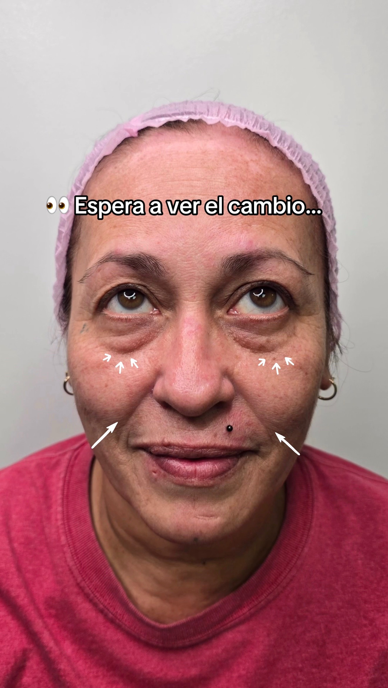 @Est&eacute;ticaUniqueFacialCovarrubia