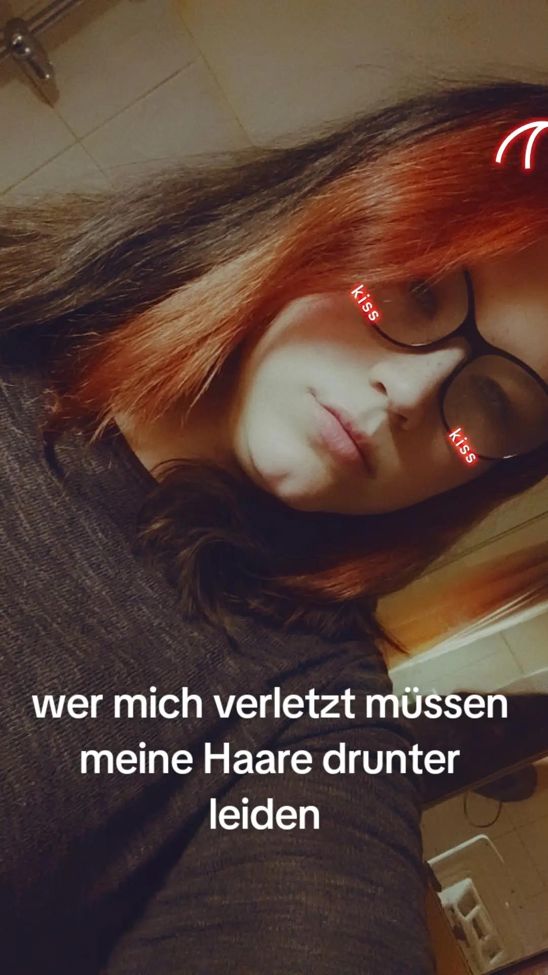 @anett