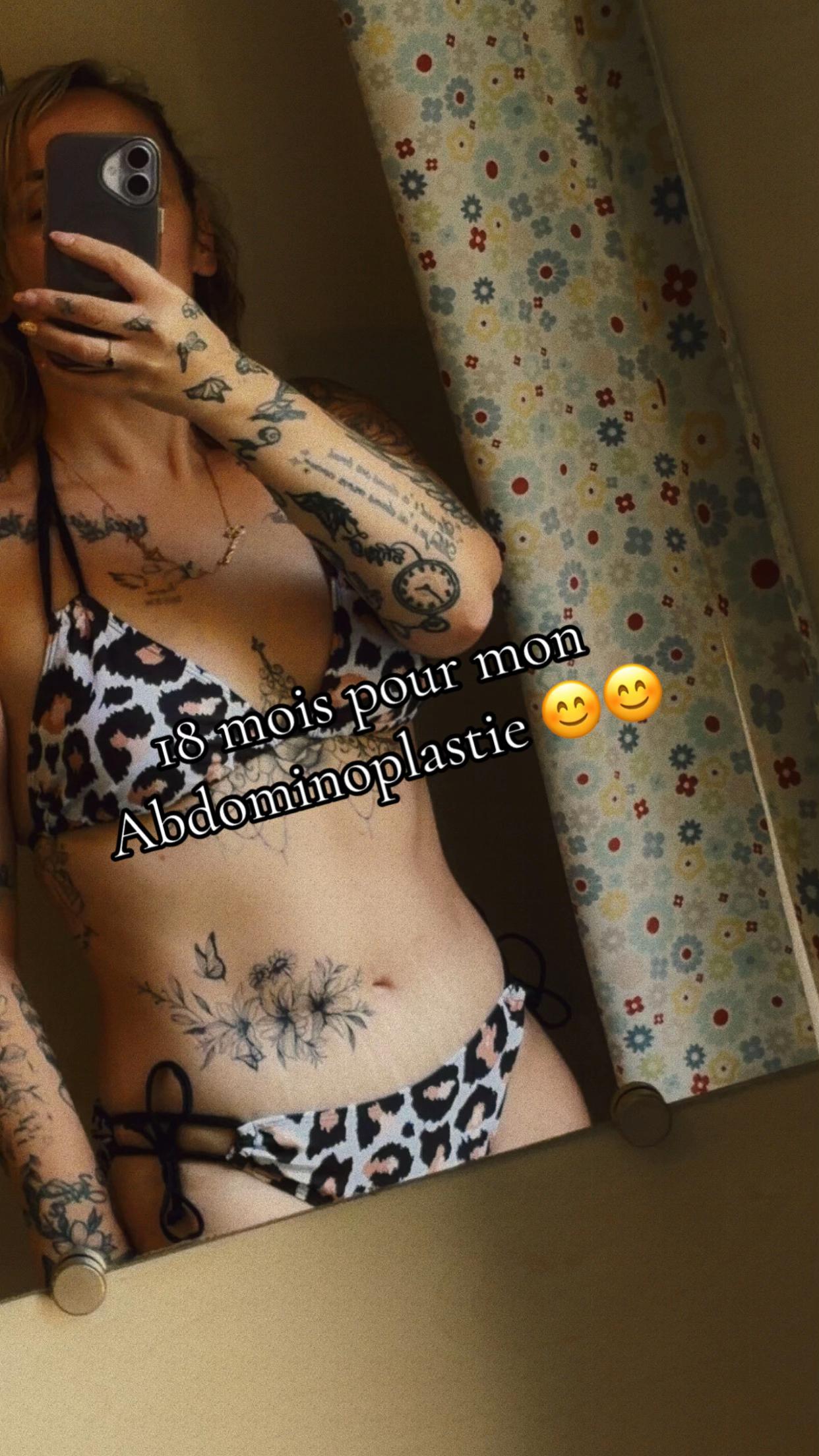 @Cindy by-pass 🎗 endometriose