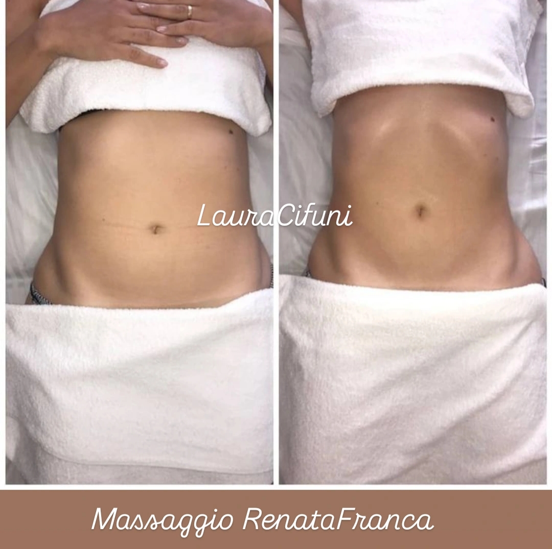 @LauraCifuni