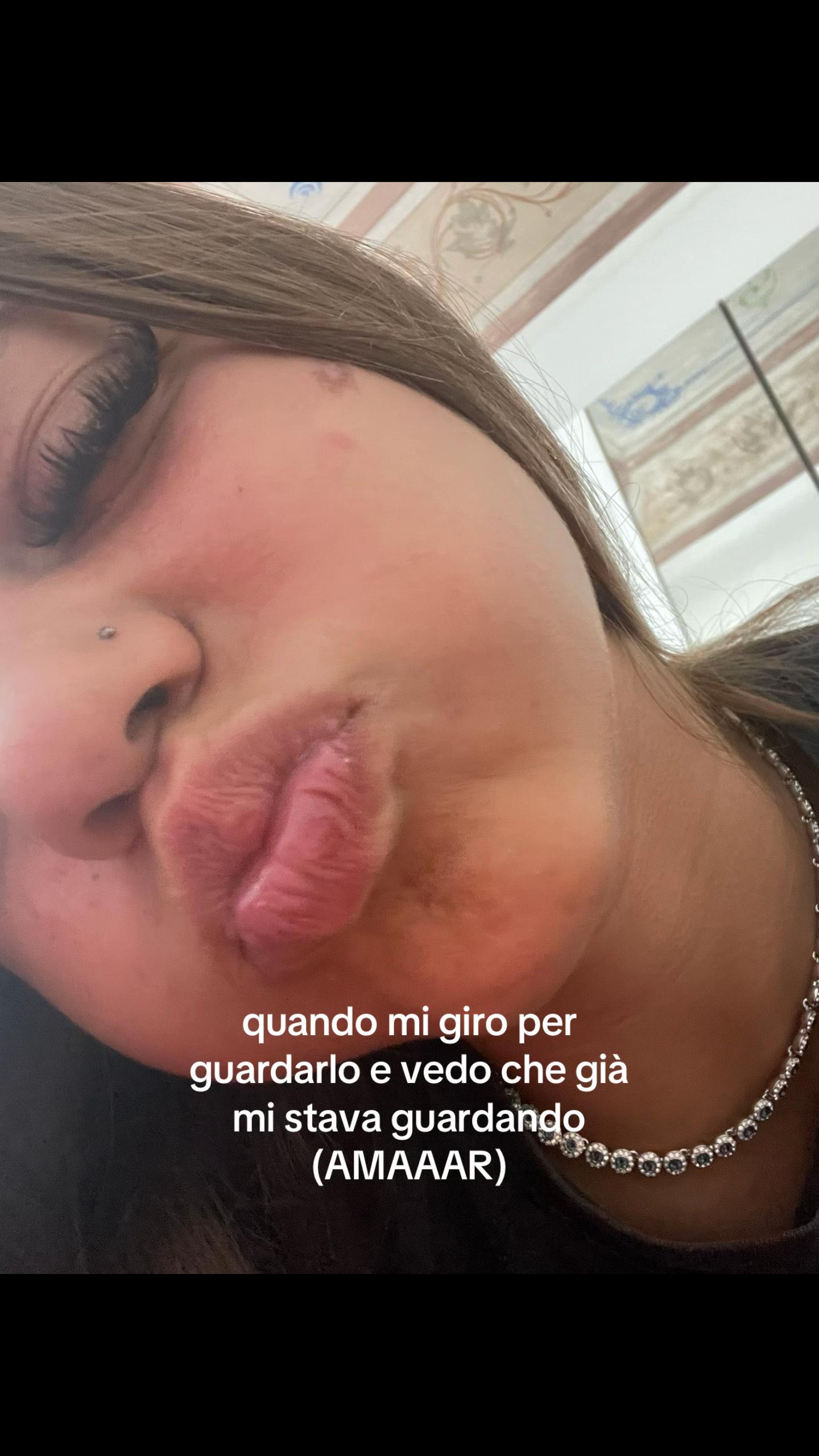 @🪼