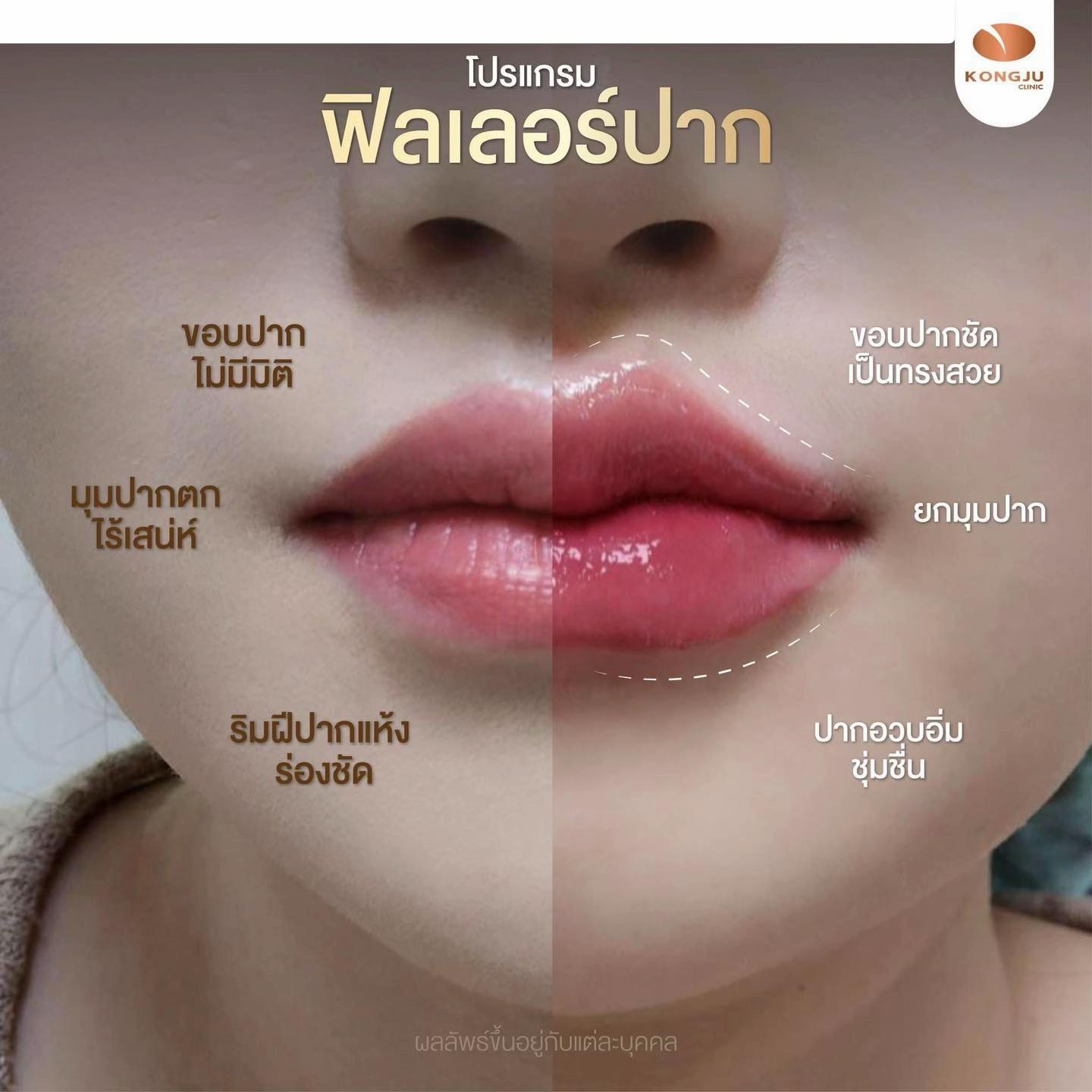 @กองจู พัทยา