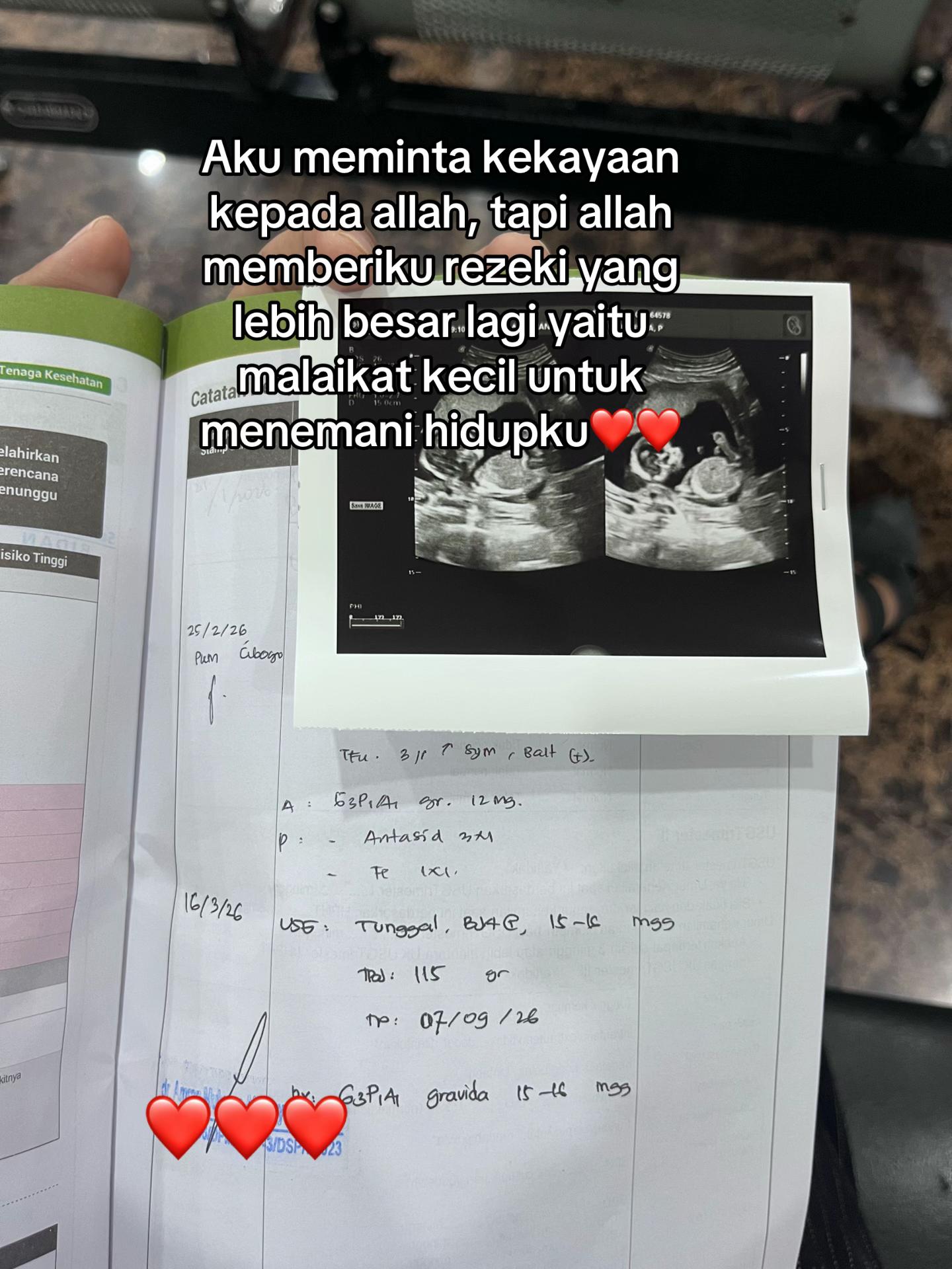 @Akunbaru