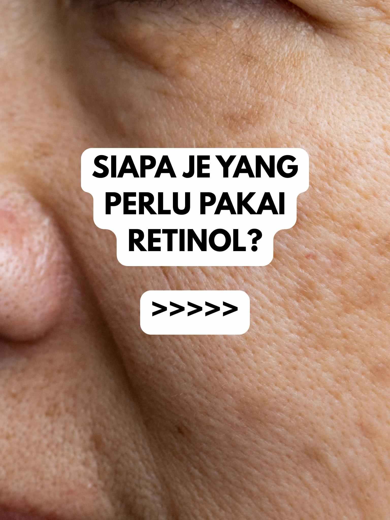@Mervably Skin