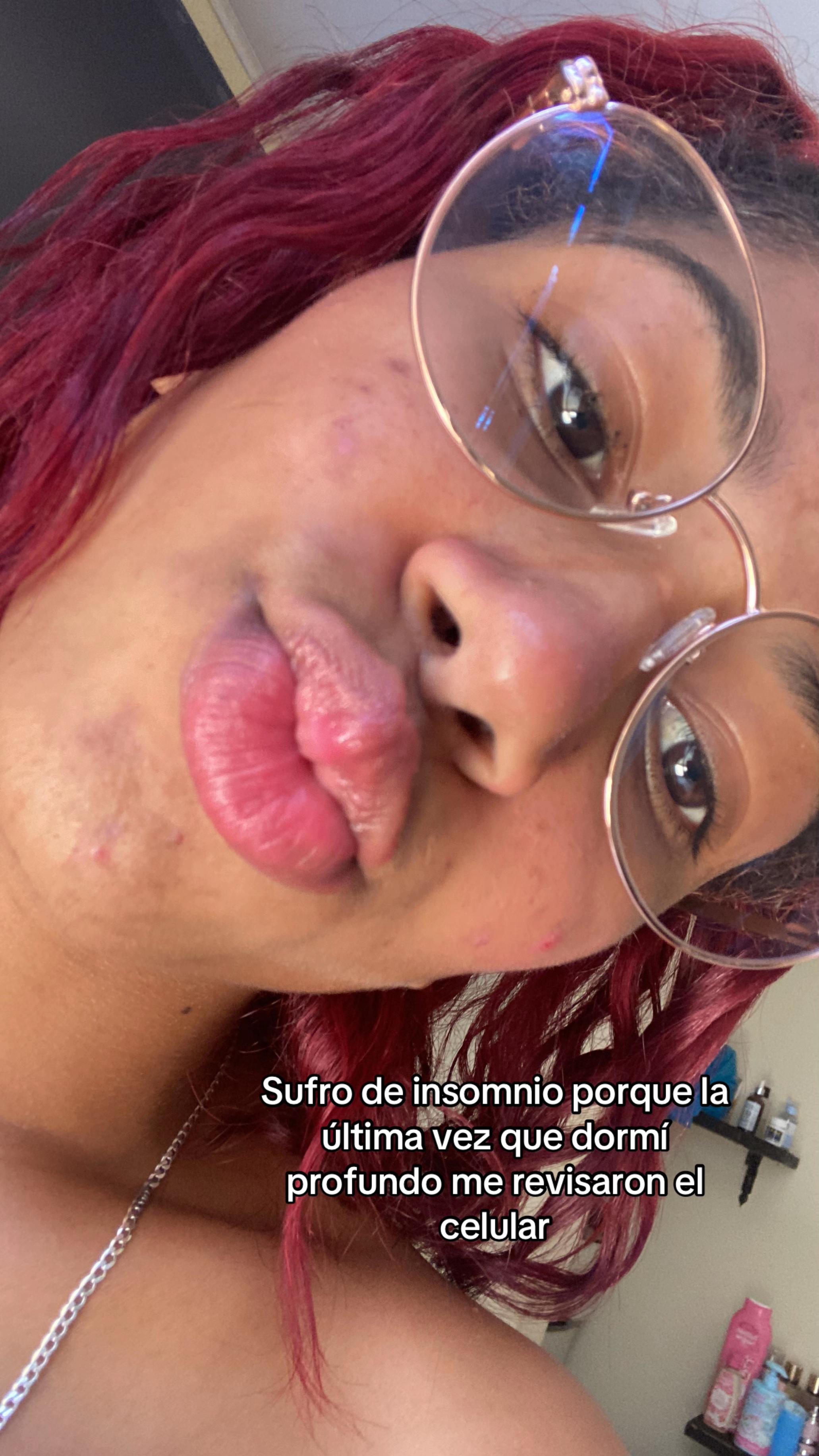@🍒
