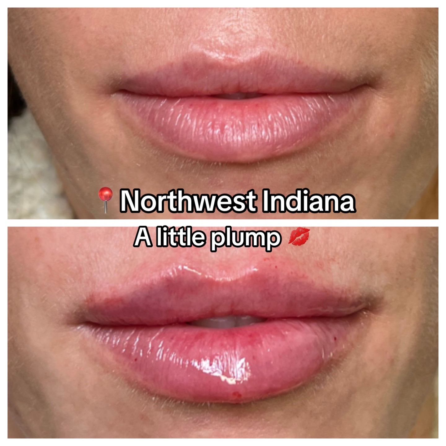 @Christy - NWI Aesthetic NP