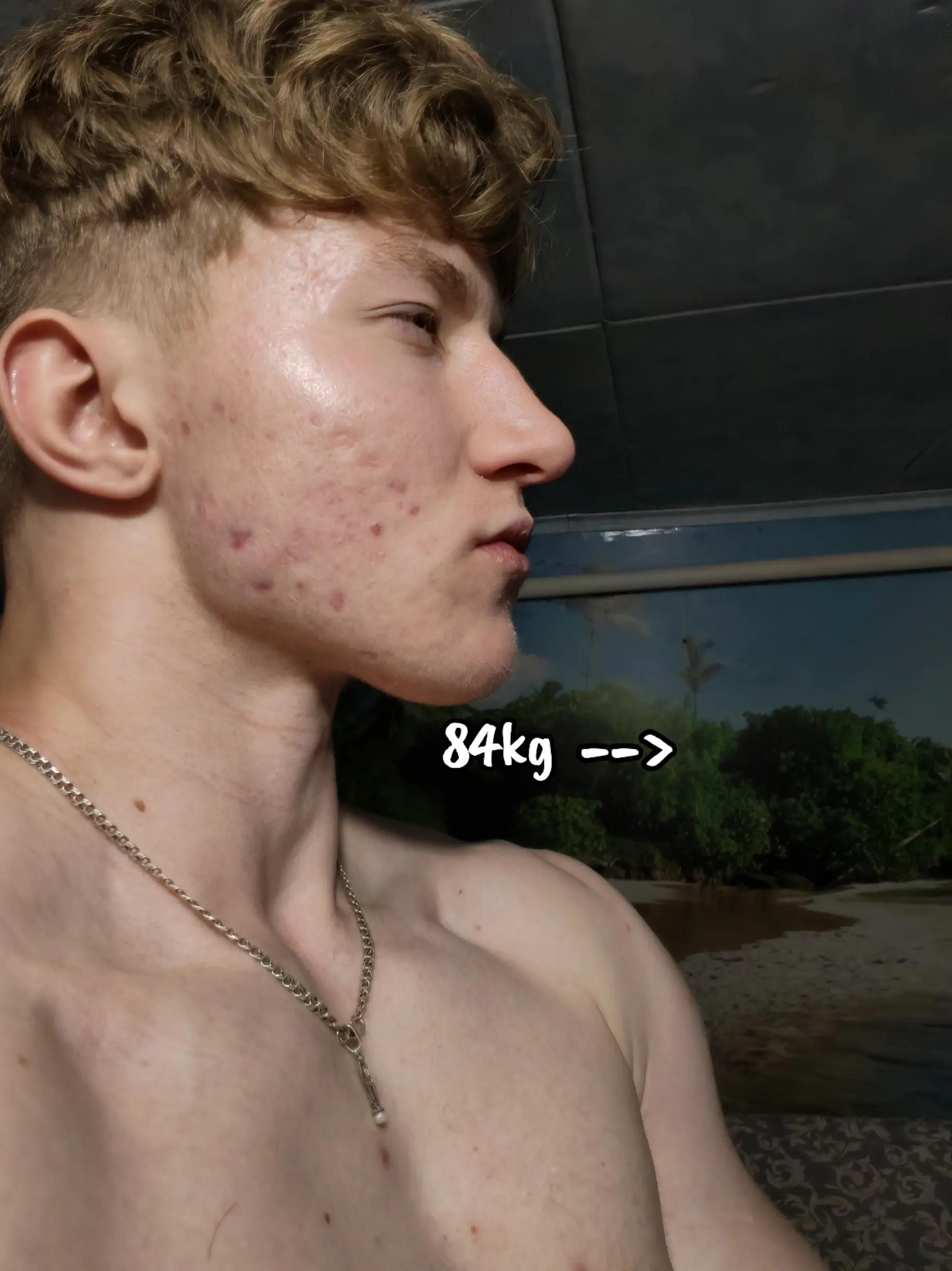 @ARM_Vnuk