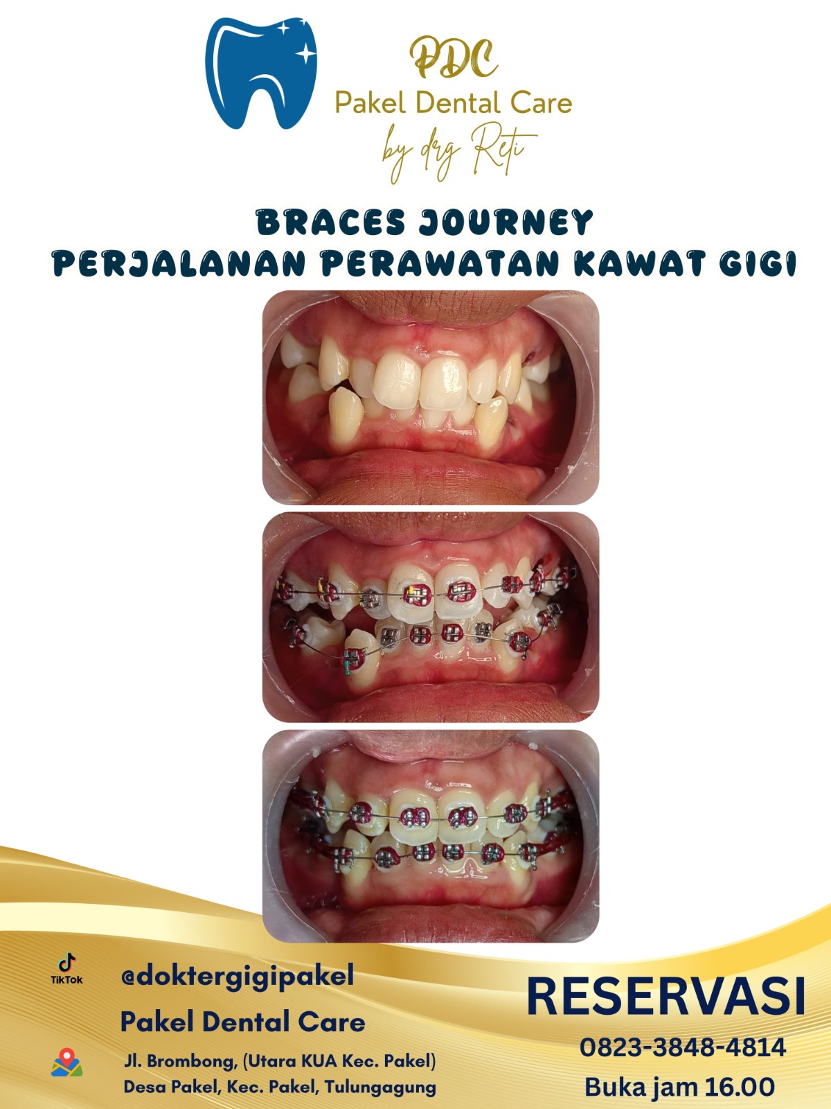@Pakeldentalcare
