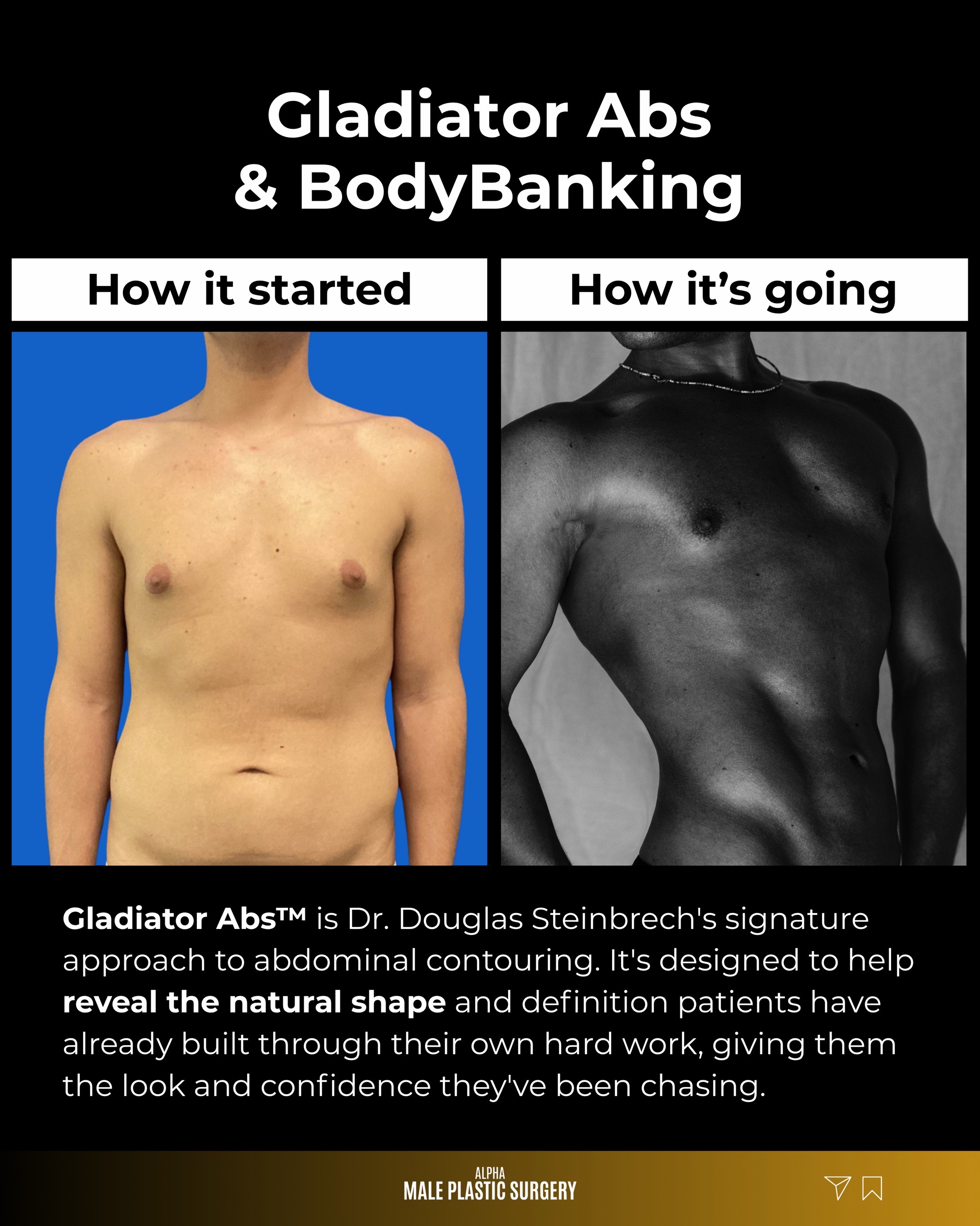 @mensplasticsurgery