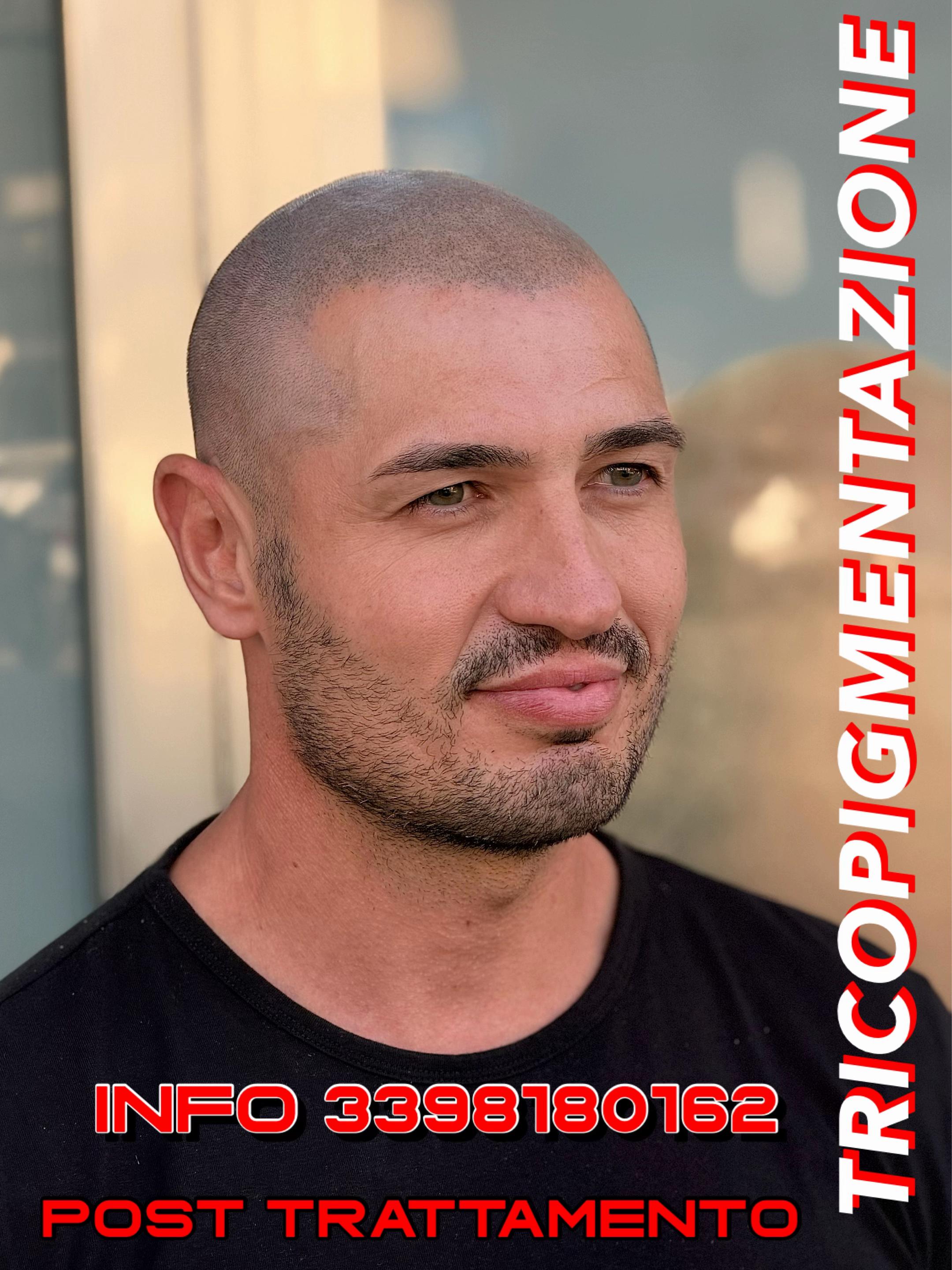 @TricoSolution di Davide Tini