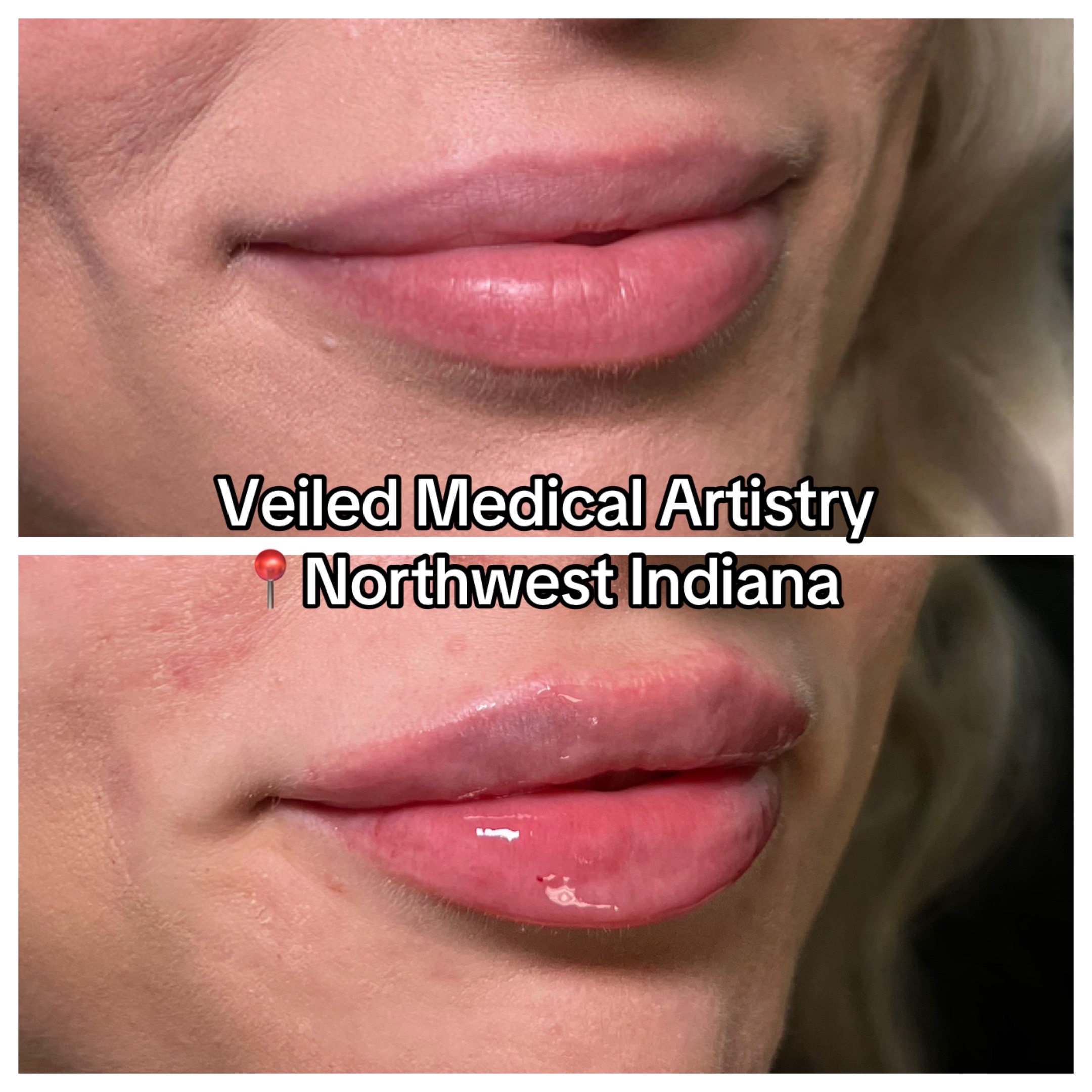 @Christy - NWI Aesthetic NP