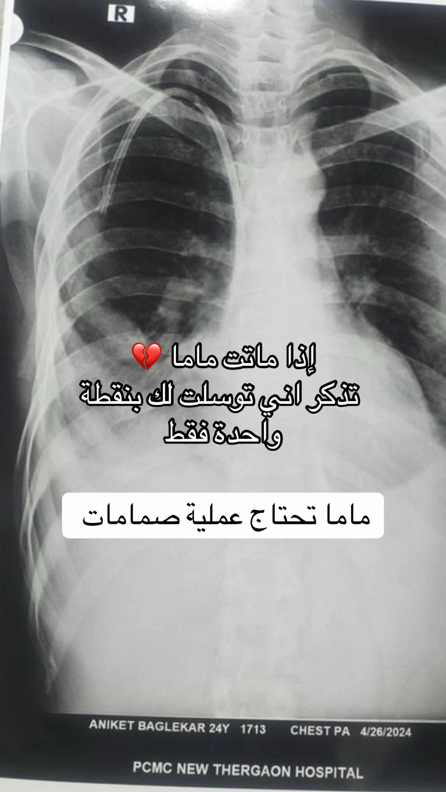 @MALAK