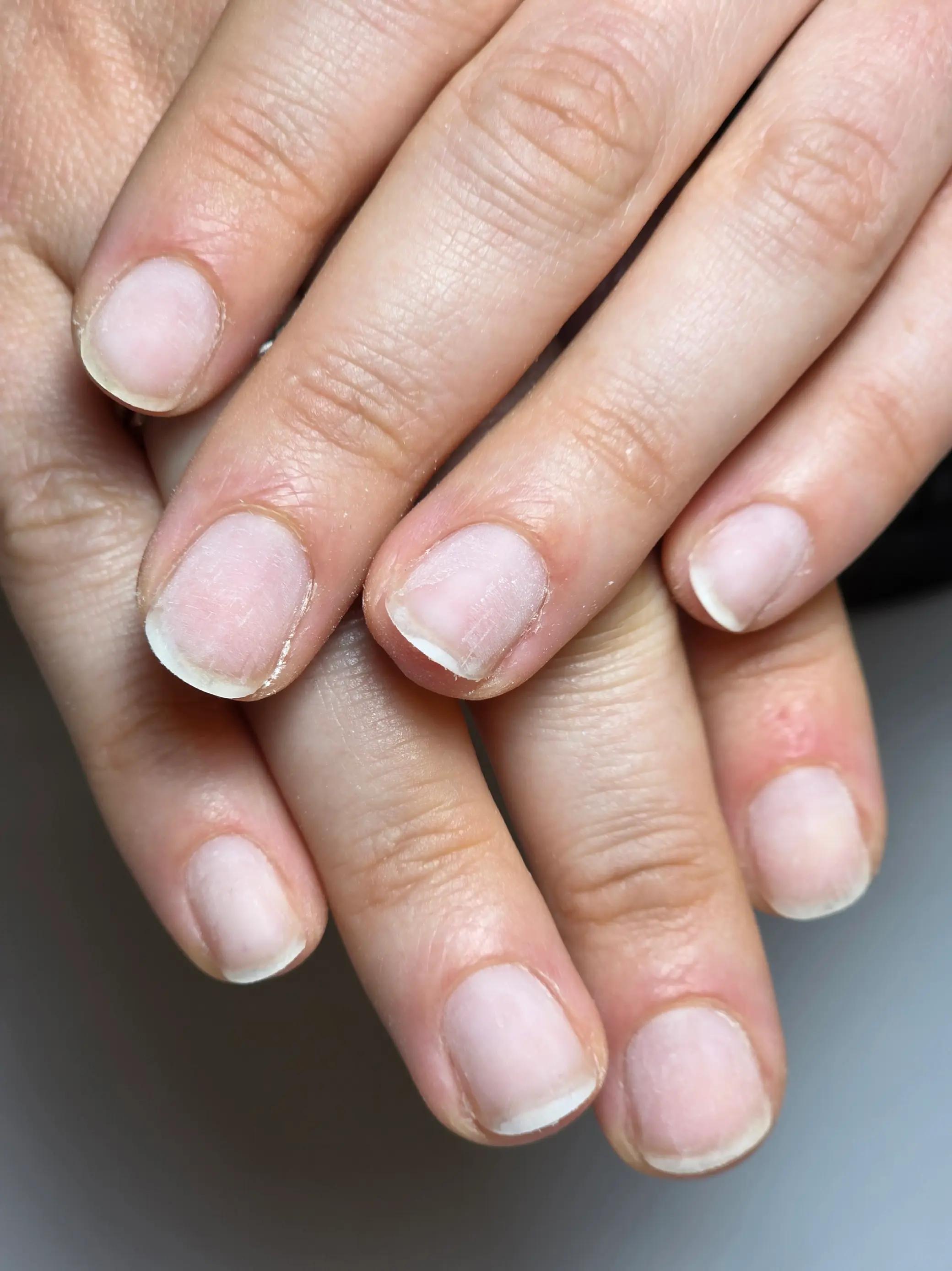 @PurelyNails