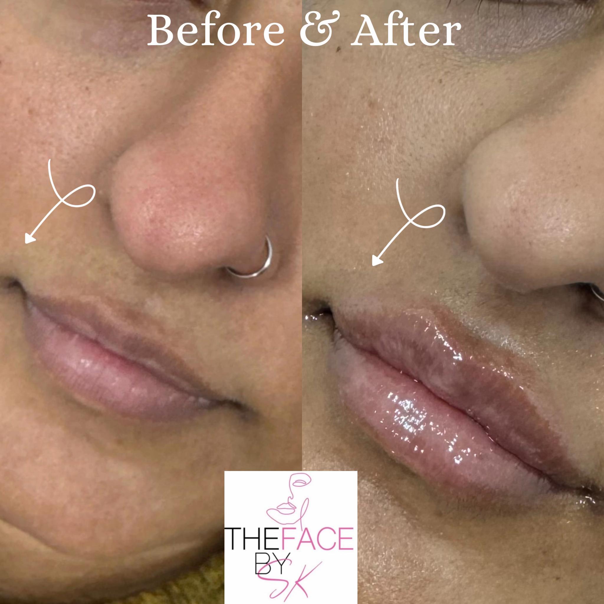 @The Facebysk