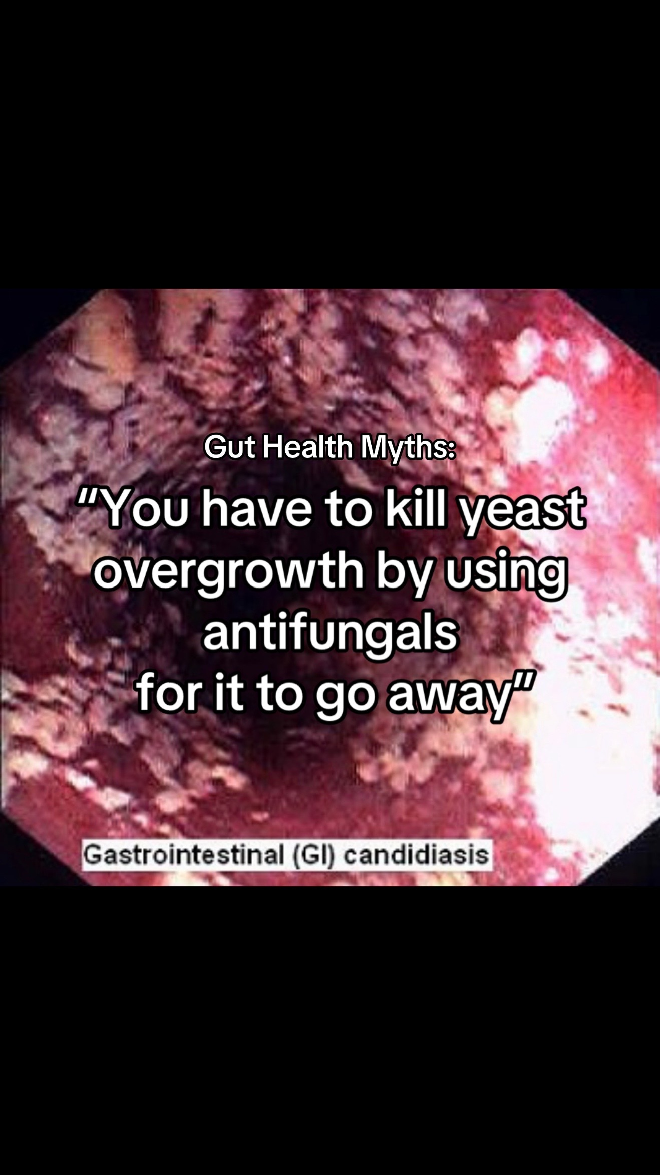@Gut Health