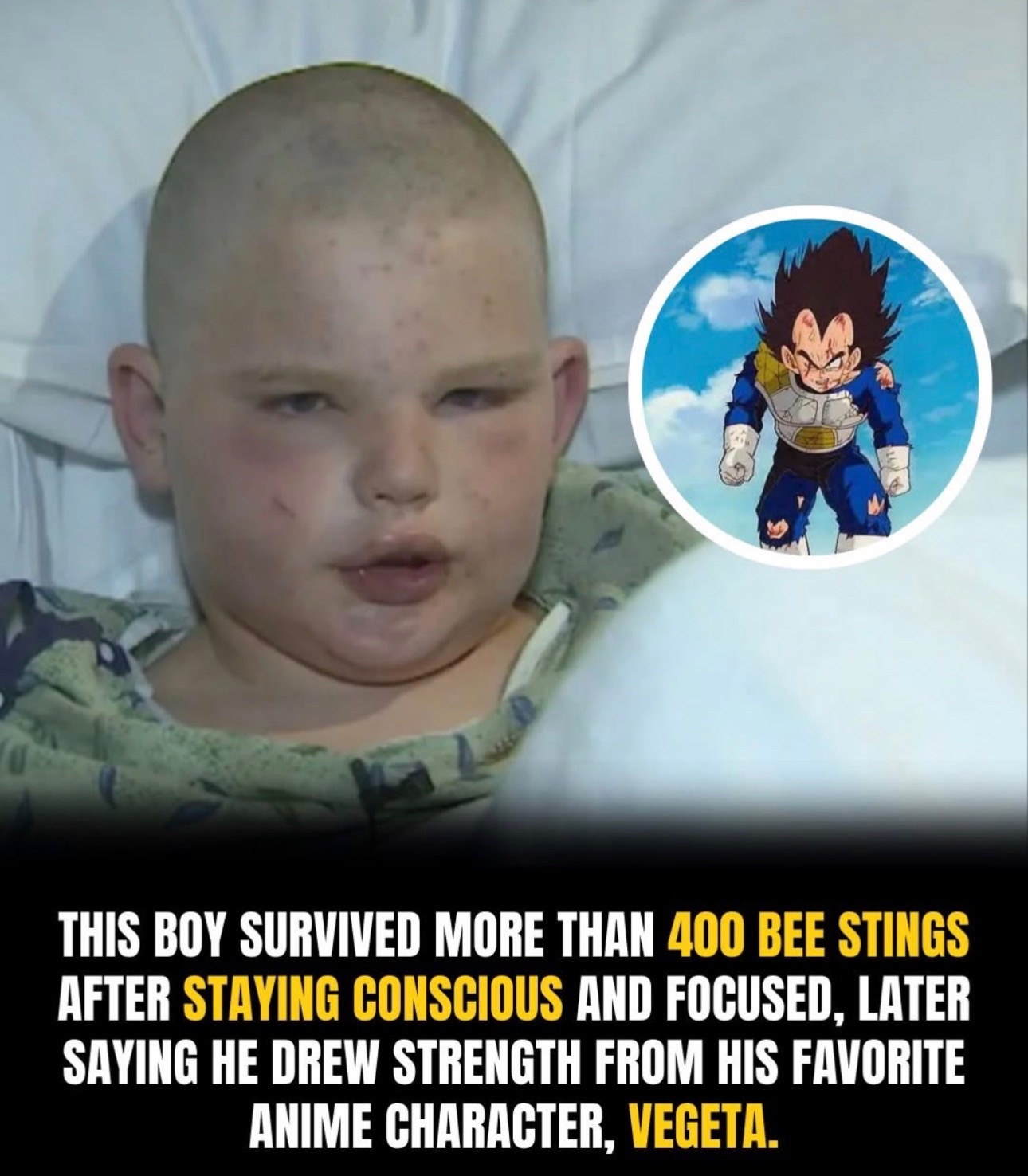 @Mentally ill beekeeper