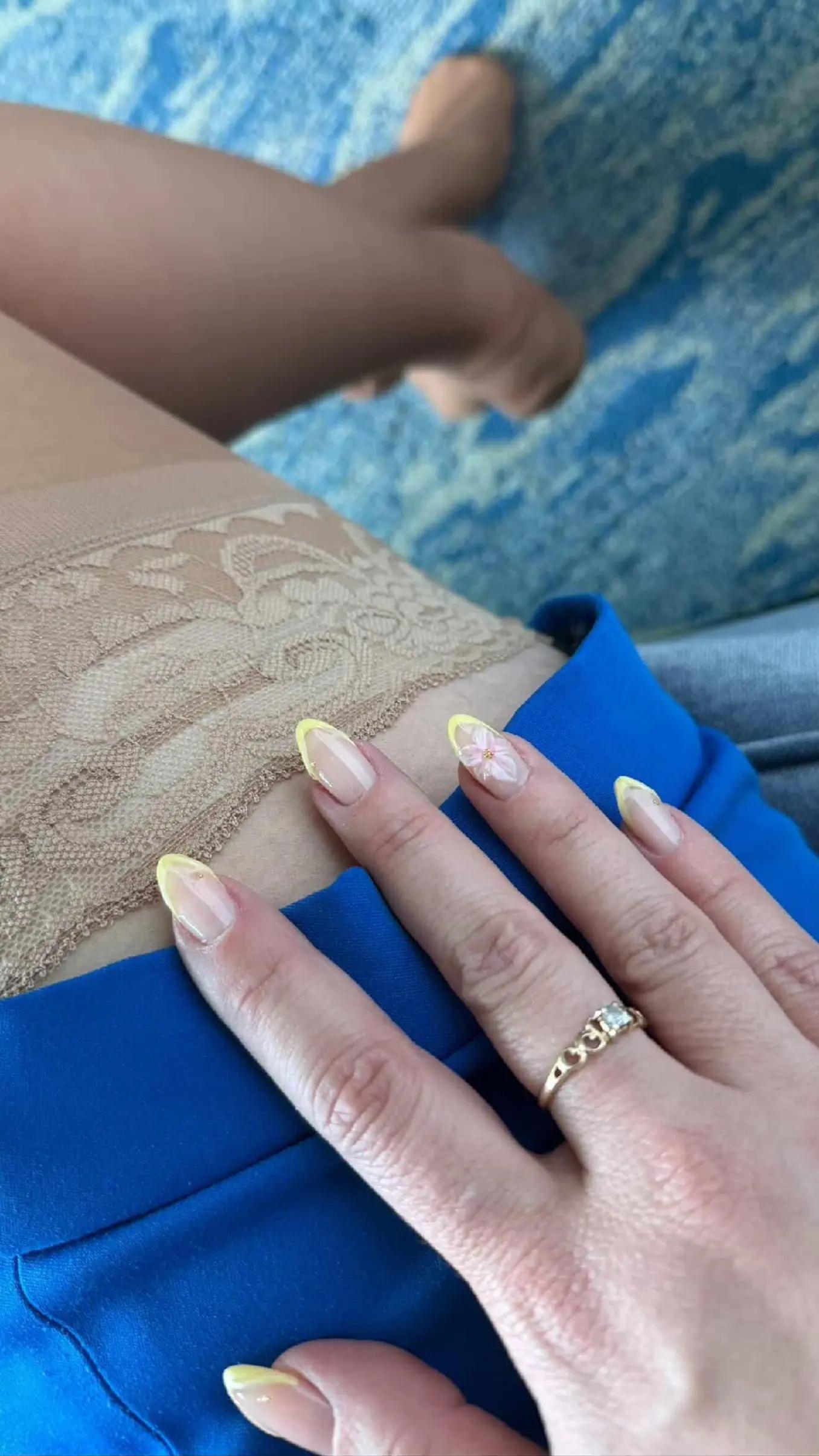 @SKYTIGHTS