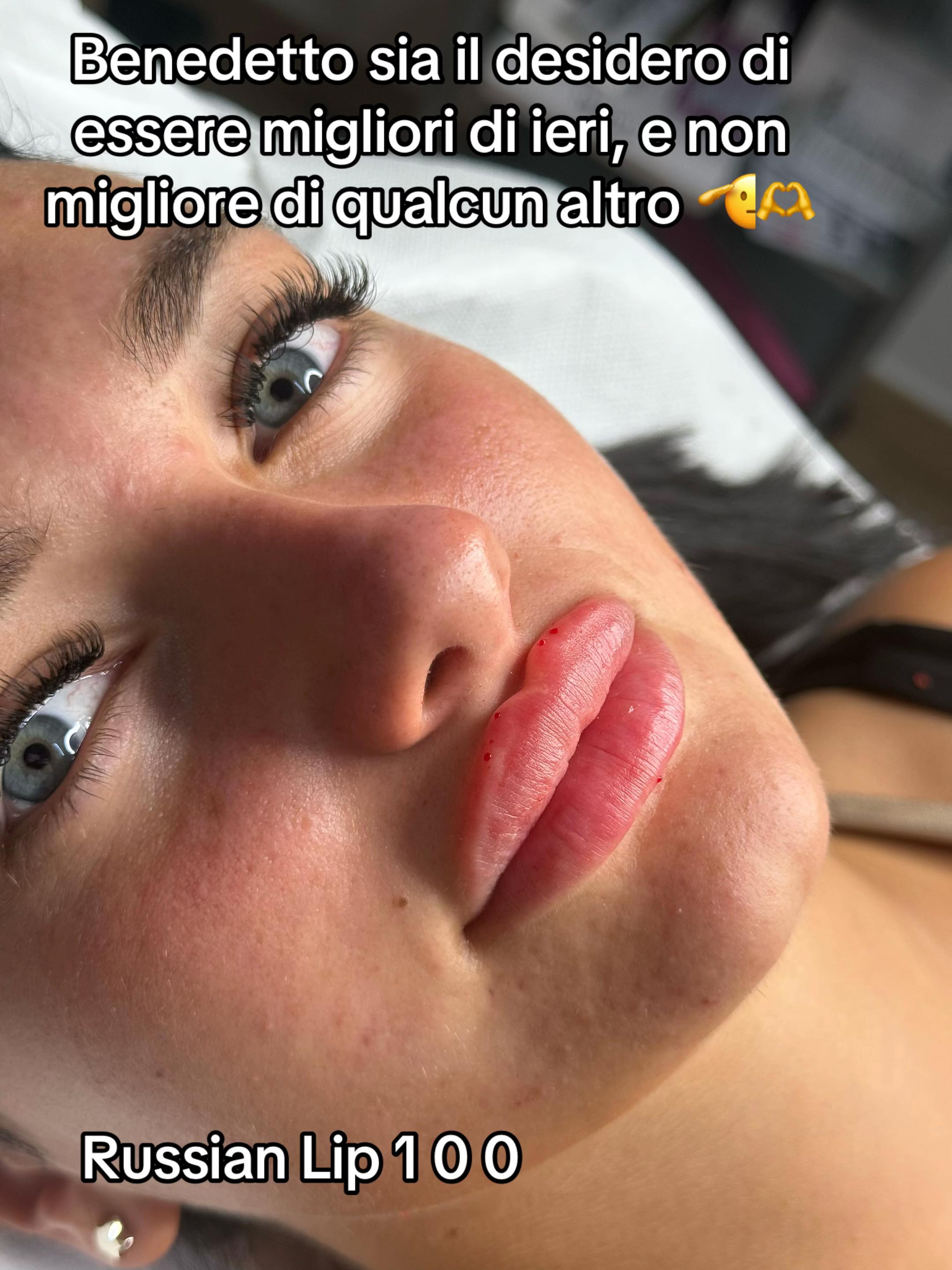 @Rosa.medical.cosmetic💉💕