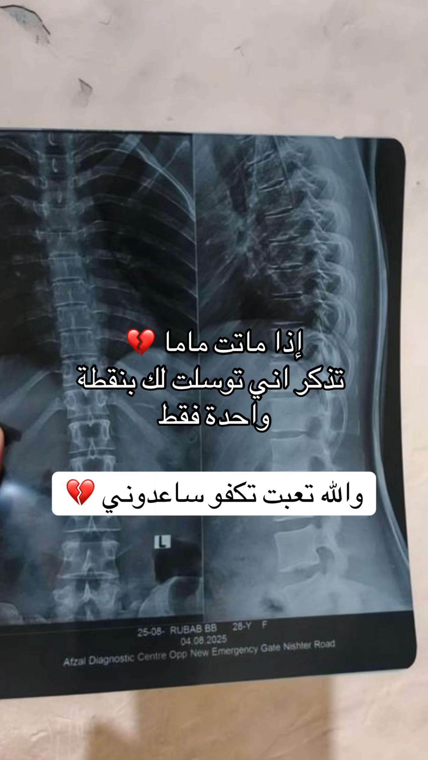 @MALAK