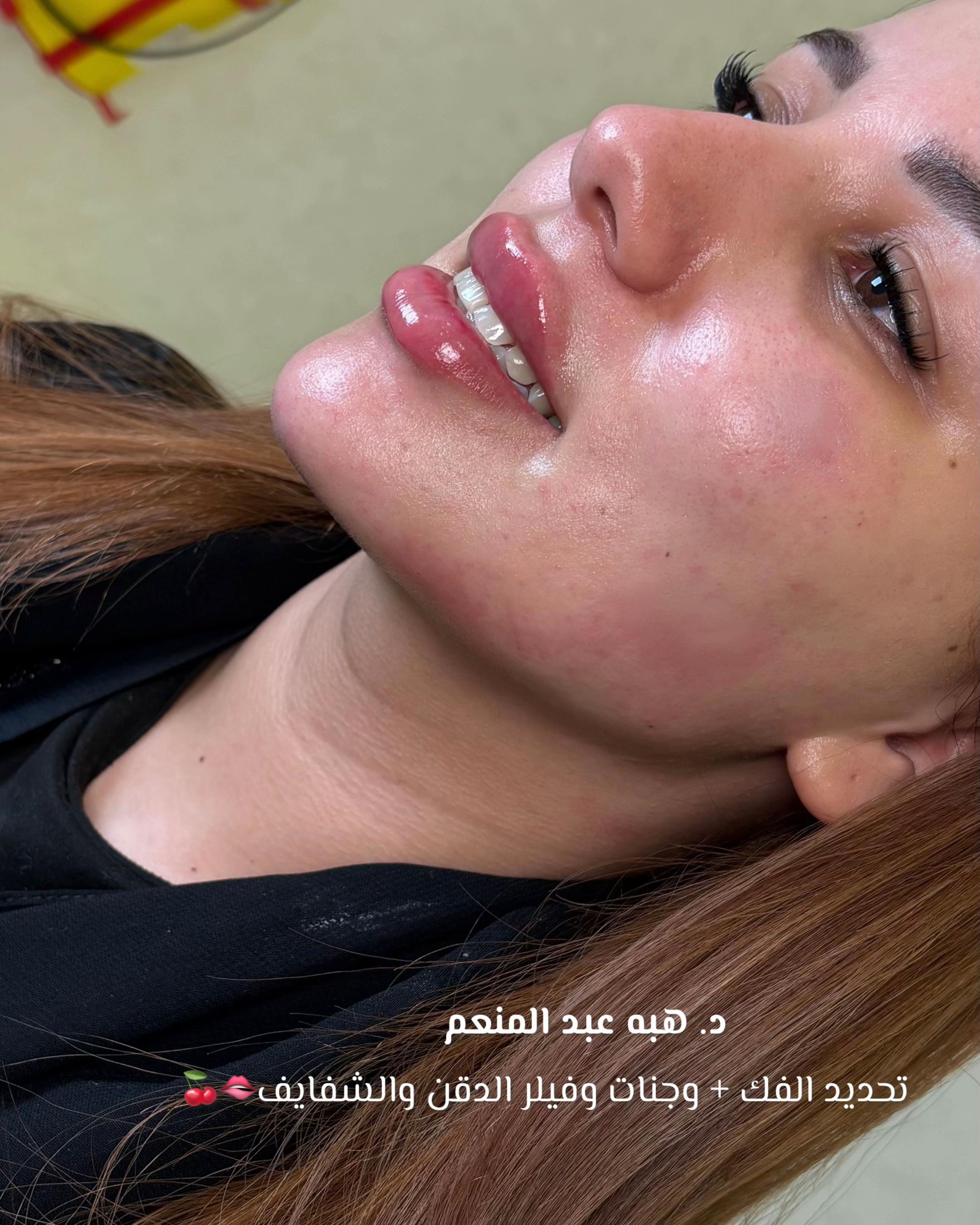 @مزدانه (فرع الملك عبدالله)